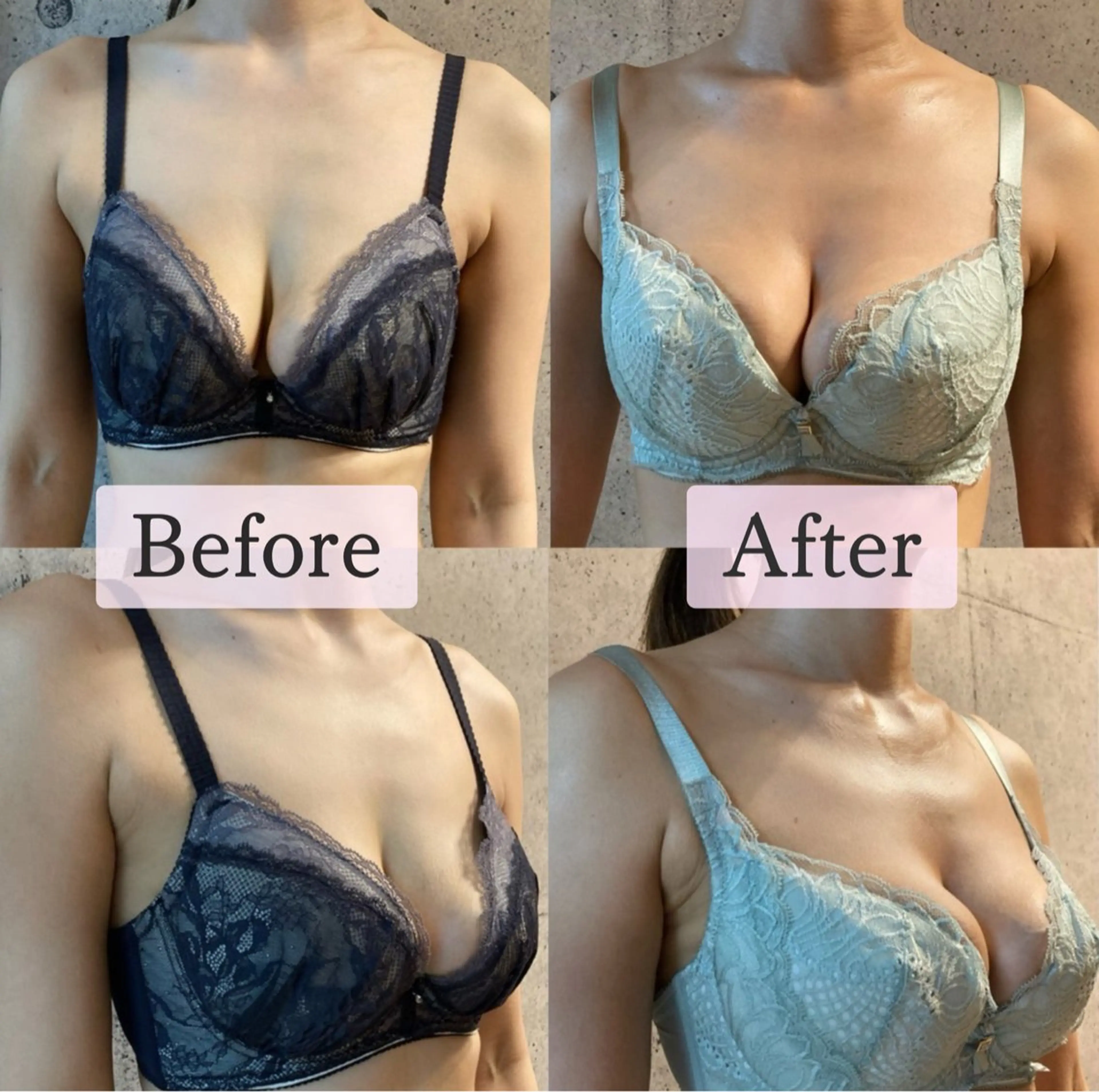 ポテンツァ&針美容 バストアップ専門店のエステ・リラクイメージ