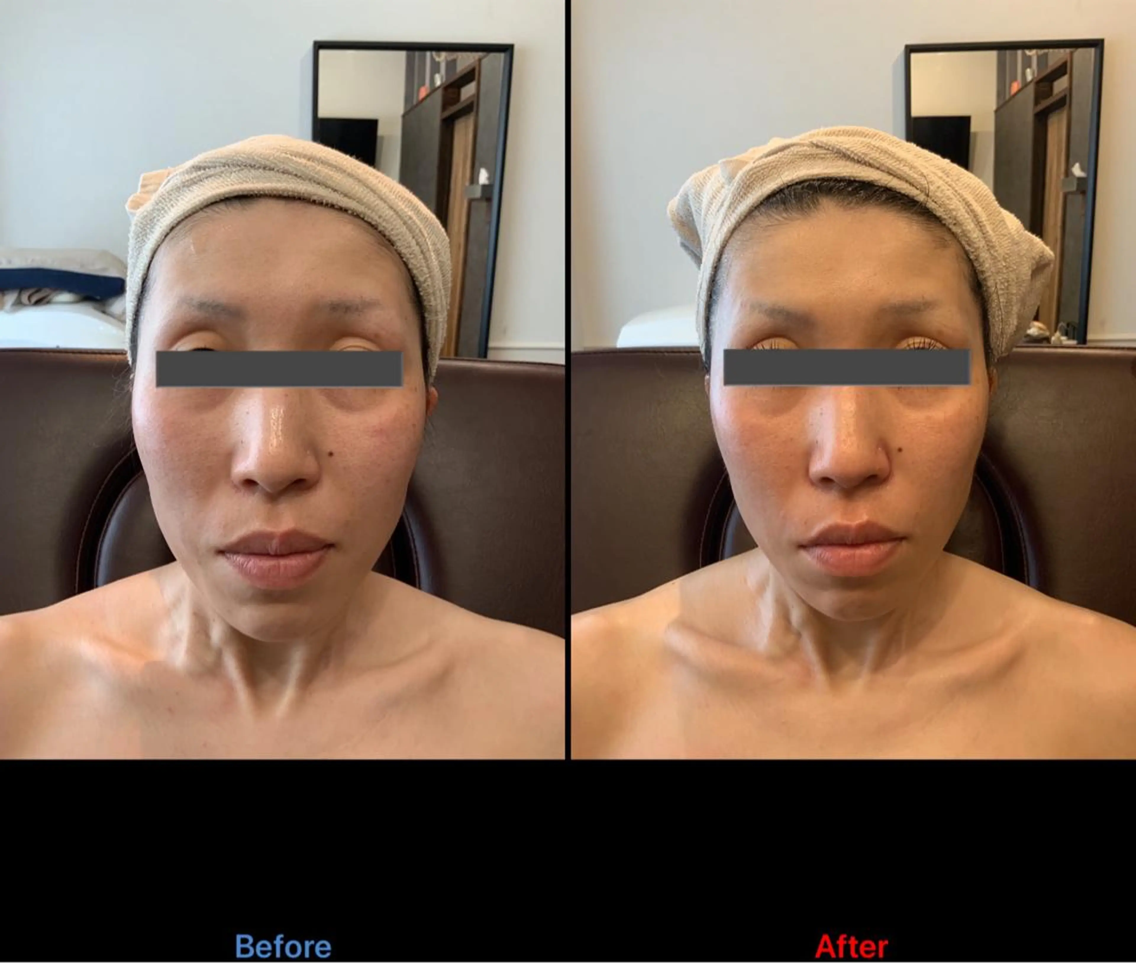 VOYAGE所属・圧倒的効果❤️‍🔥 VOYAGE ヤマダのエステ・リラクイメージ