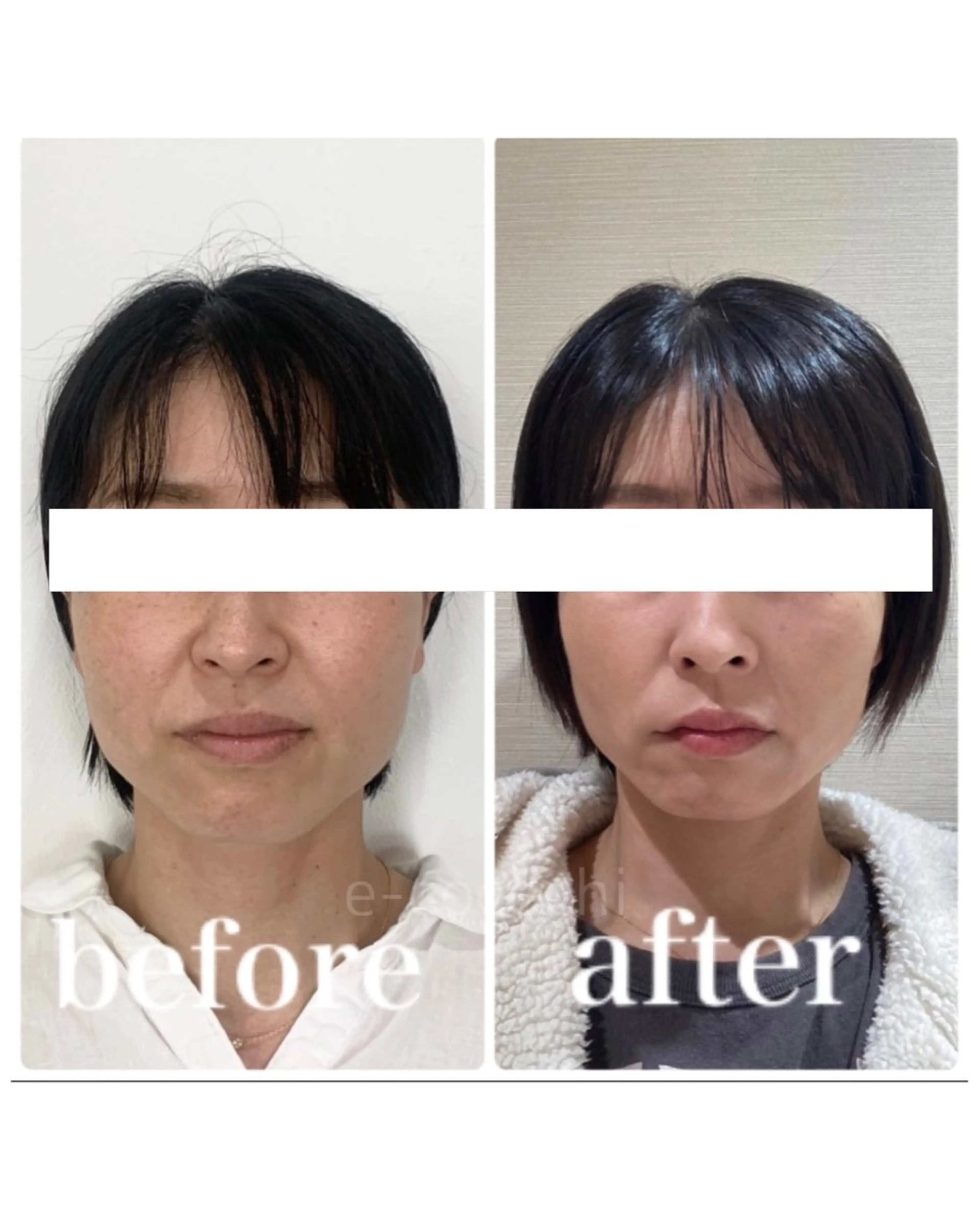 エステ リラク 小顔と ヘッドスパのお店のエステ・リラクイメージ