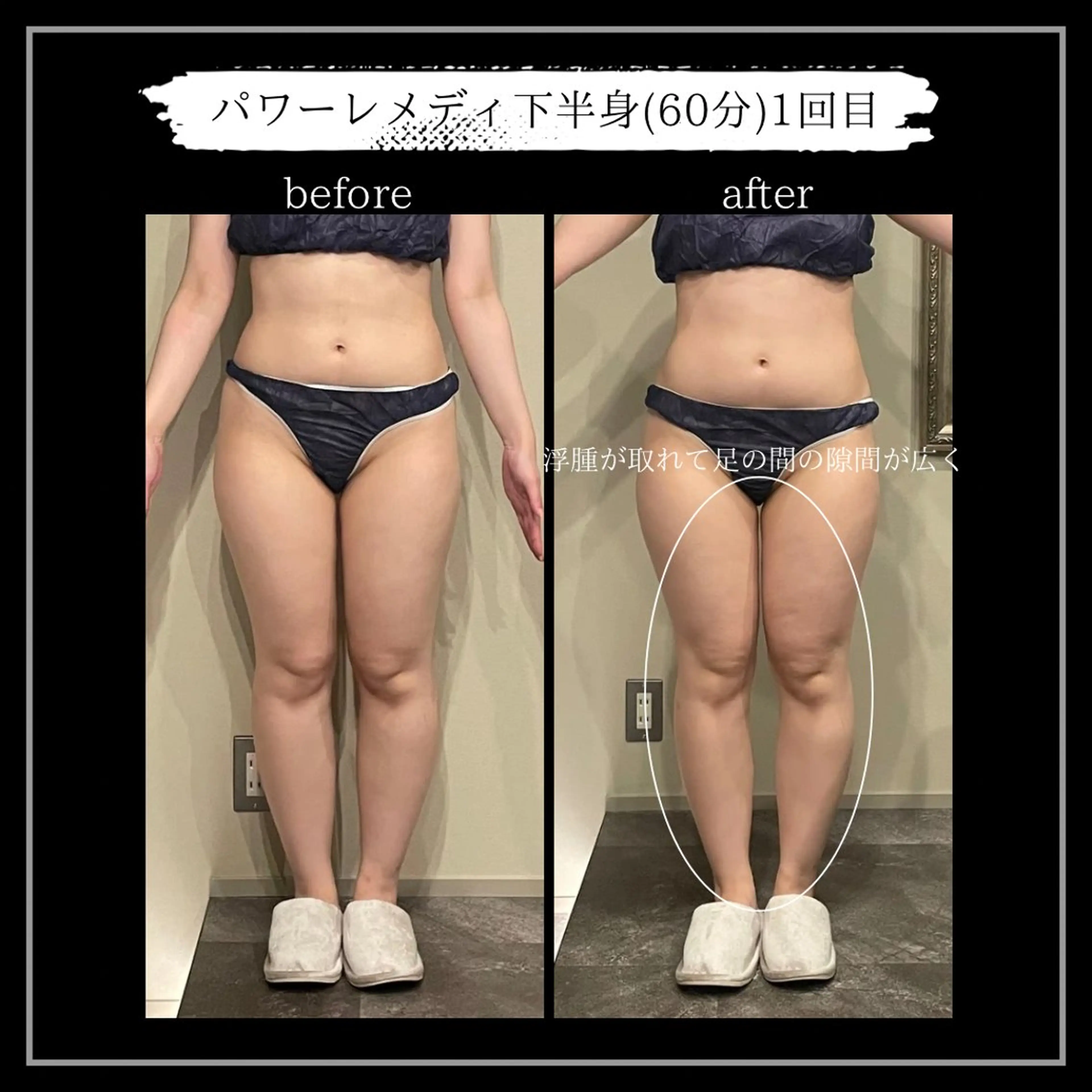 オフ:オン所属・オフ:オン 全身筋膜マッサージのエステ・リラクイメージ