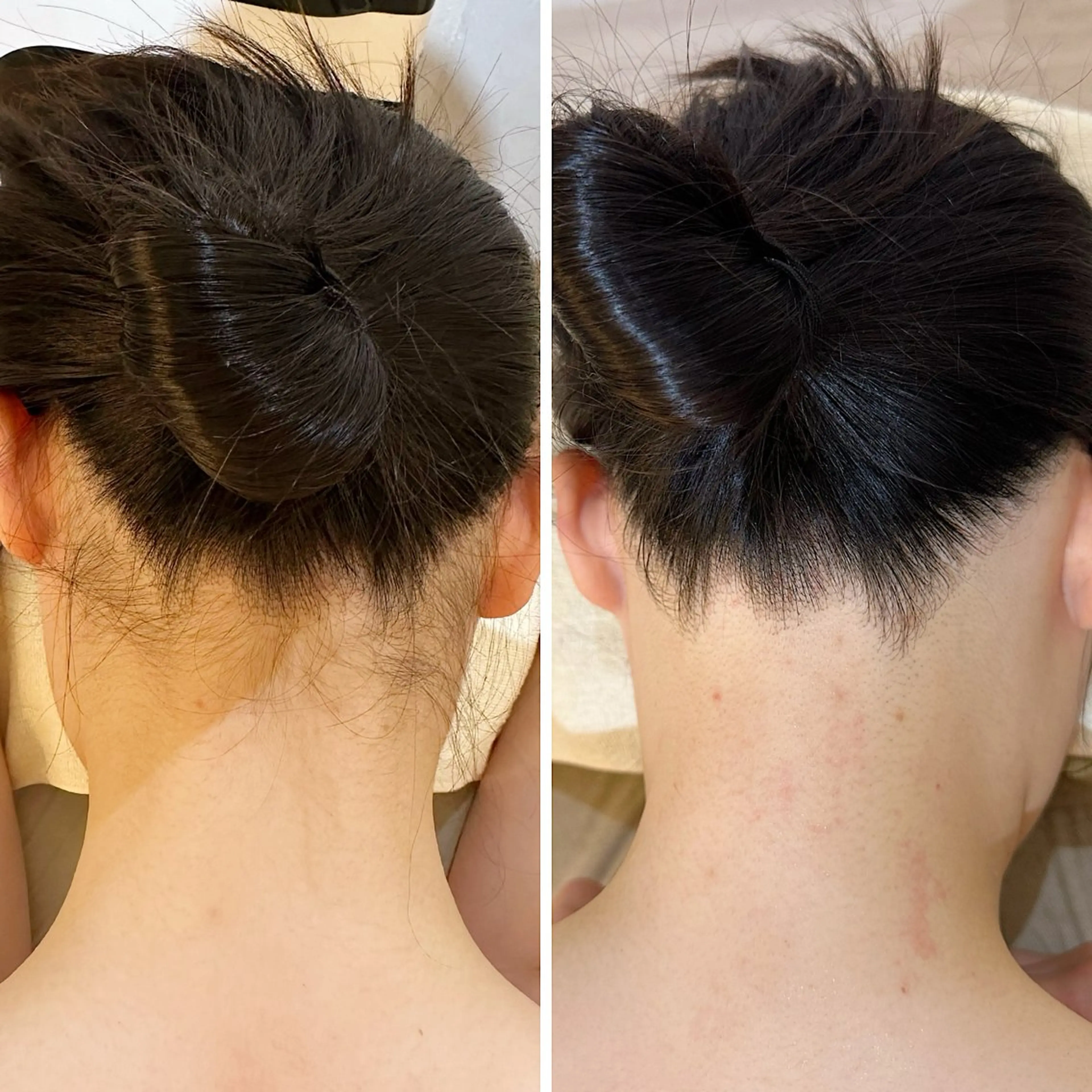 脱毛 うなじ脱毛/美肌脱毛 LABELのエステ・リラクイメージ