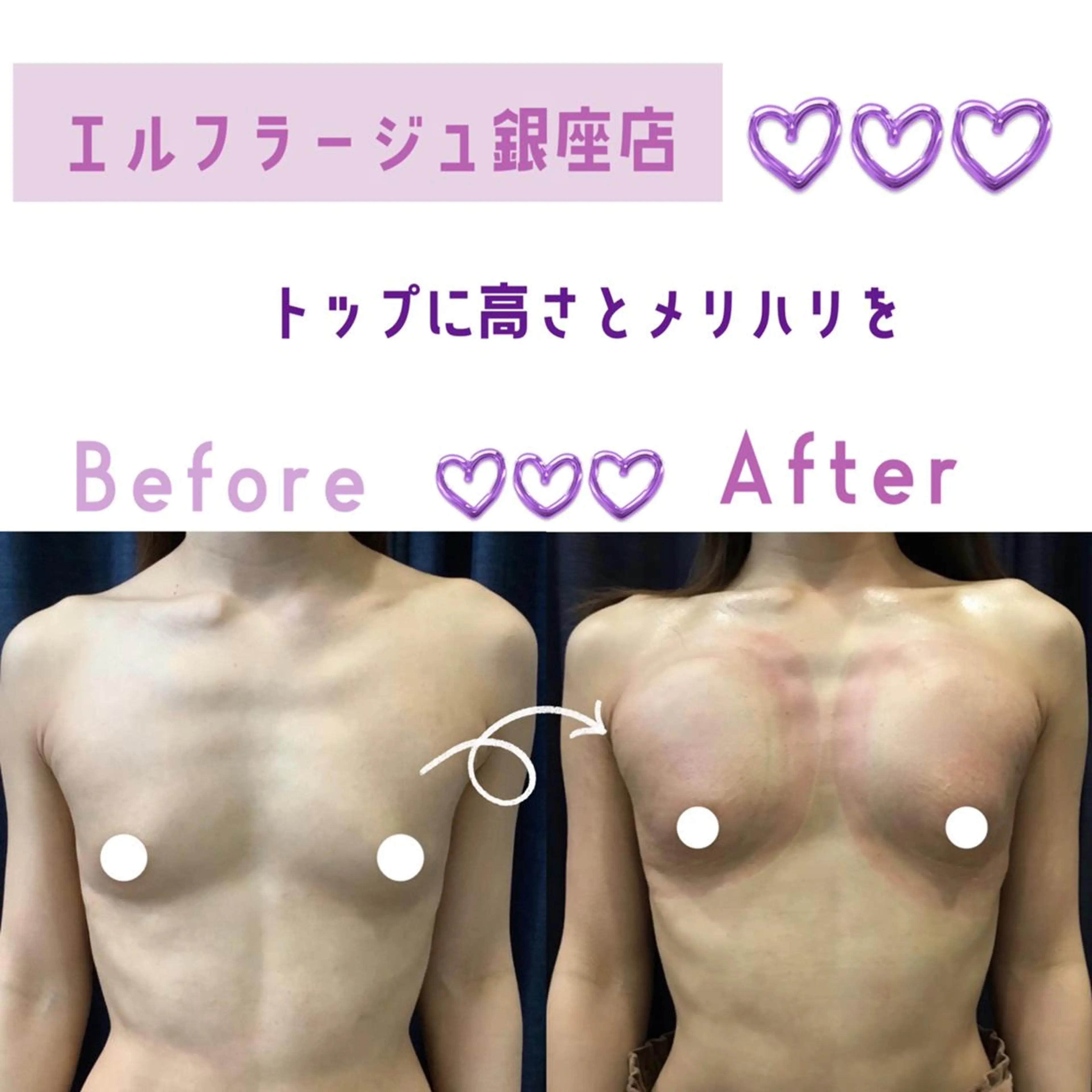 エルフラージュ 銀座店のエステ・リラクイメージ