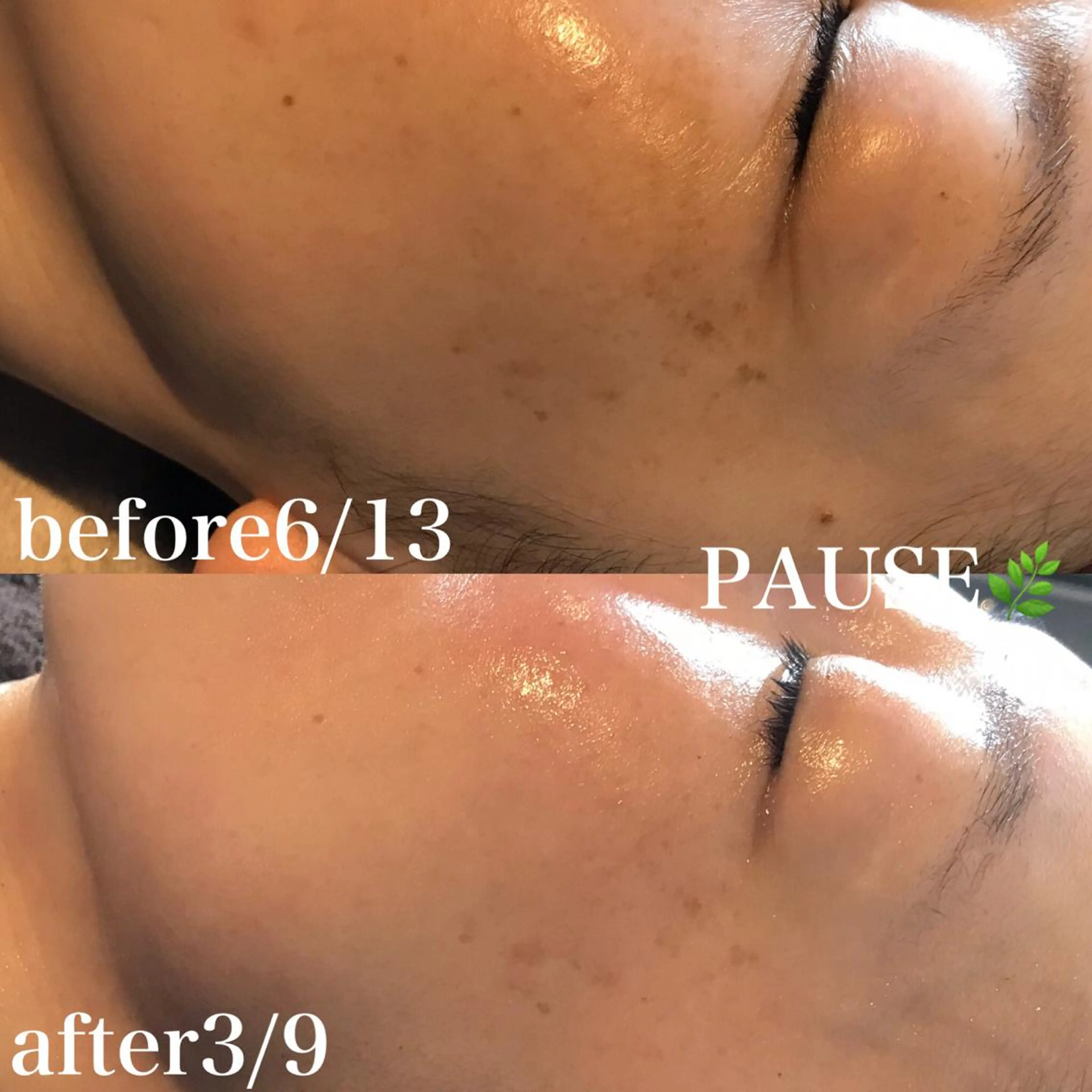 エステ 浜野 恵美のエステ・リラクイメージ