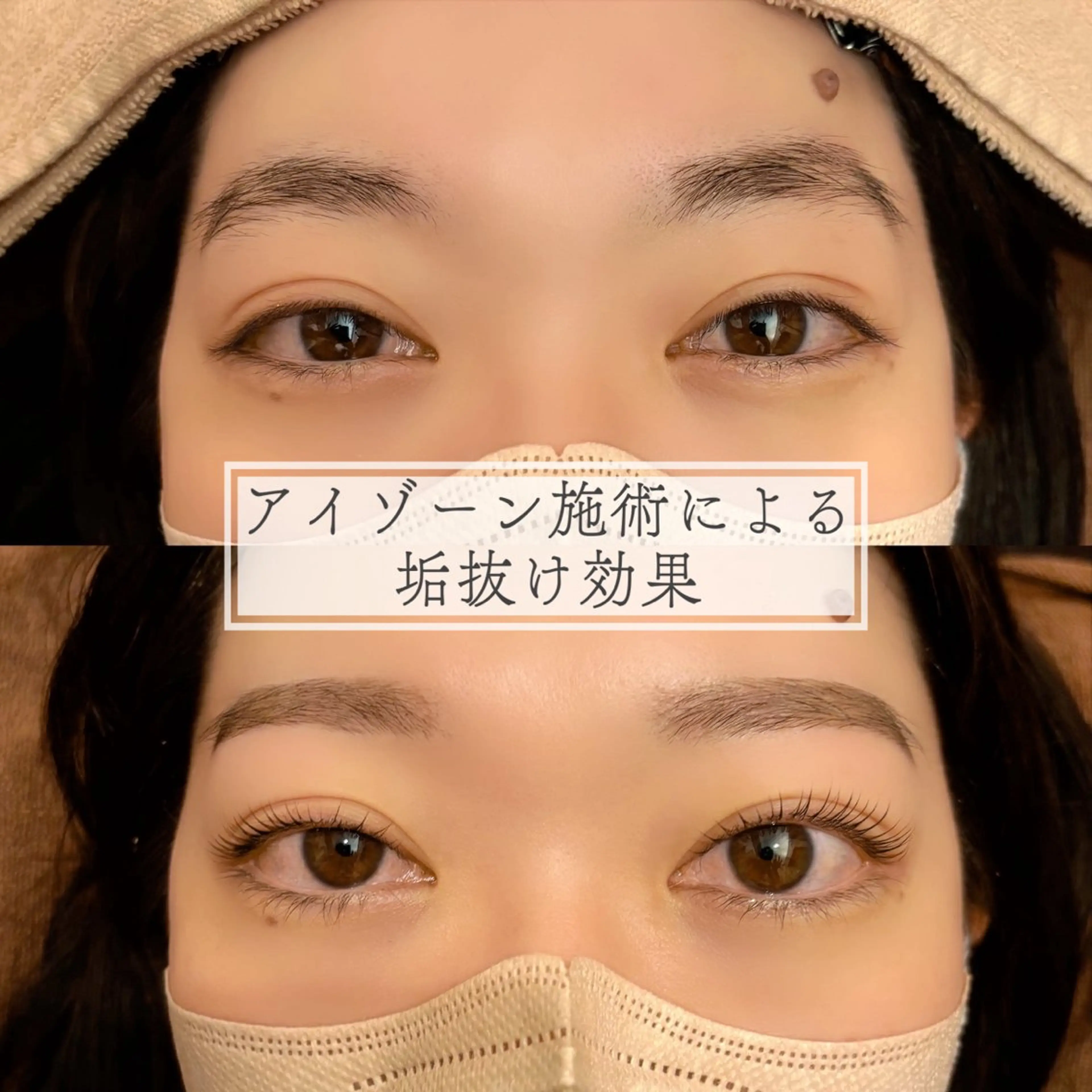 アイブロウ ワックス脱毛 その他(アイブロウ) 似合わせ♡ Teresaのマツエク・マツパデザイン