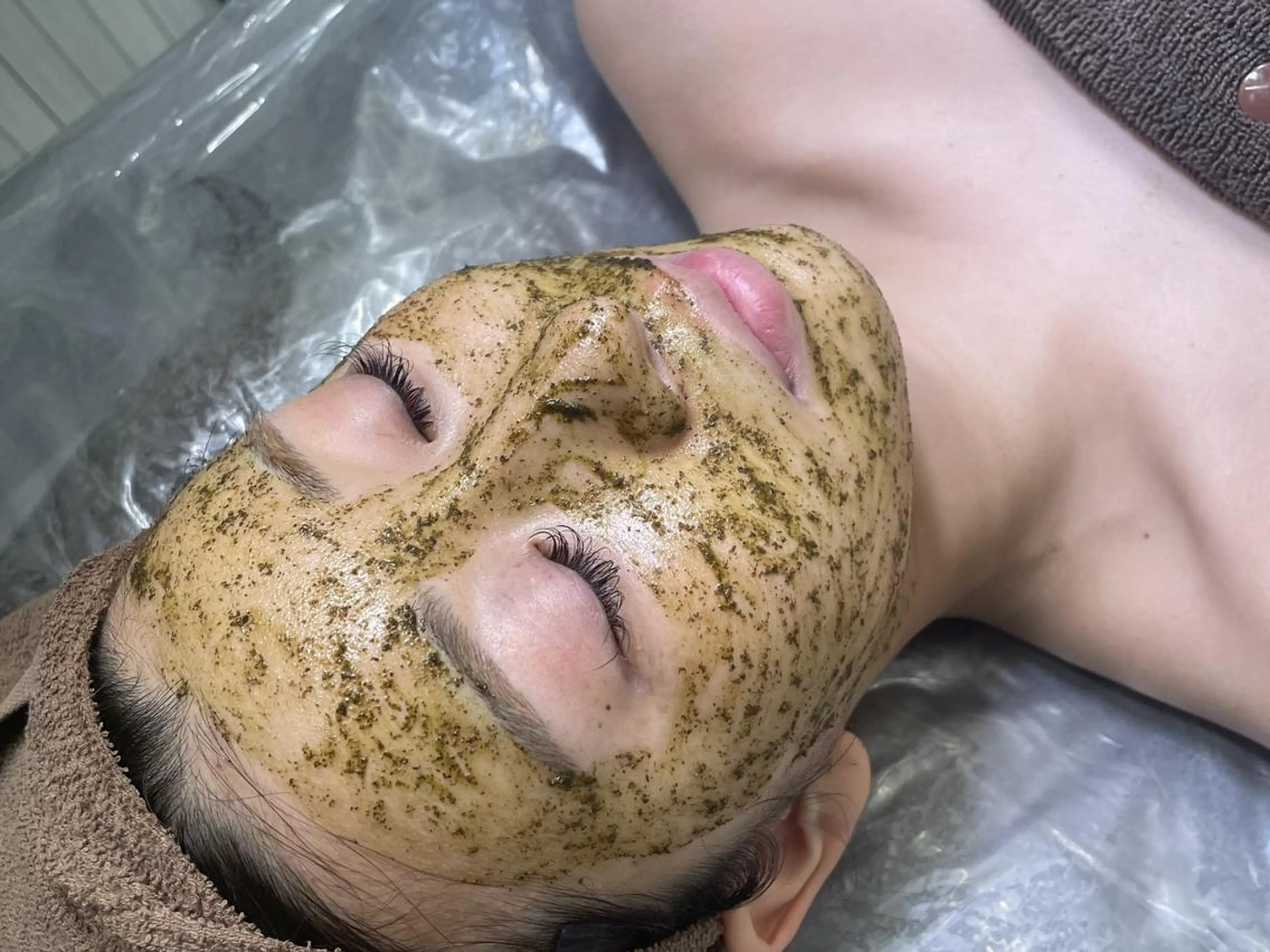 初回45%off🔥剥離無し【ハーブピーリング】🌿毛穴の汚れをデトックス🔥毛穴・ザラつき・ニキビ・くすみに💚の写真