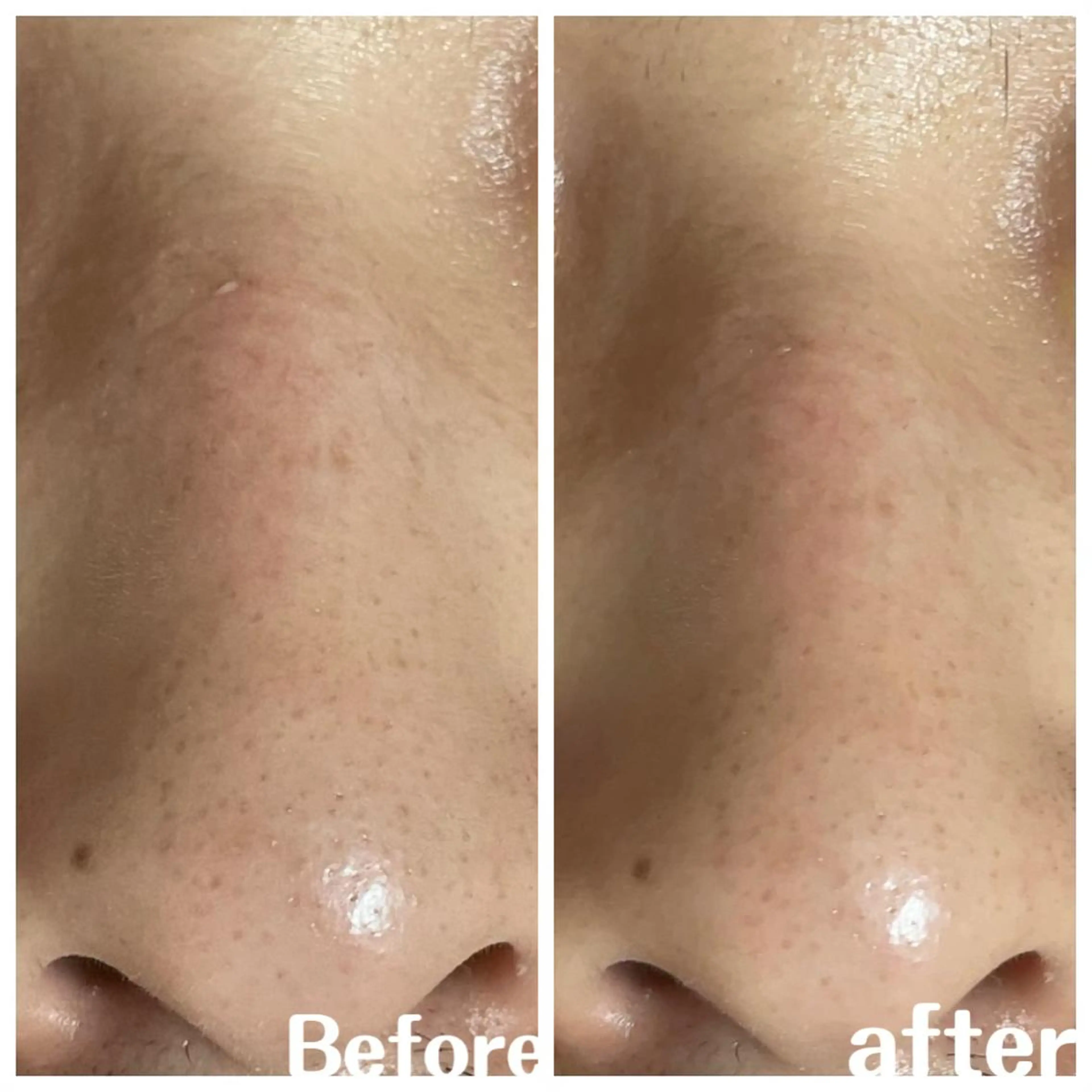 肌質改善サロン facialmoonのエステ・リラクイメージ