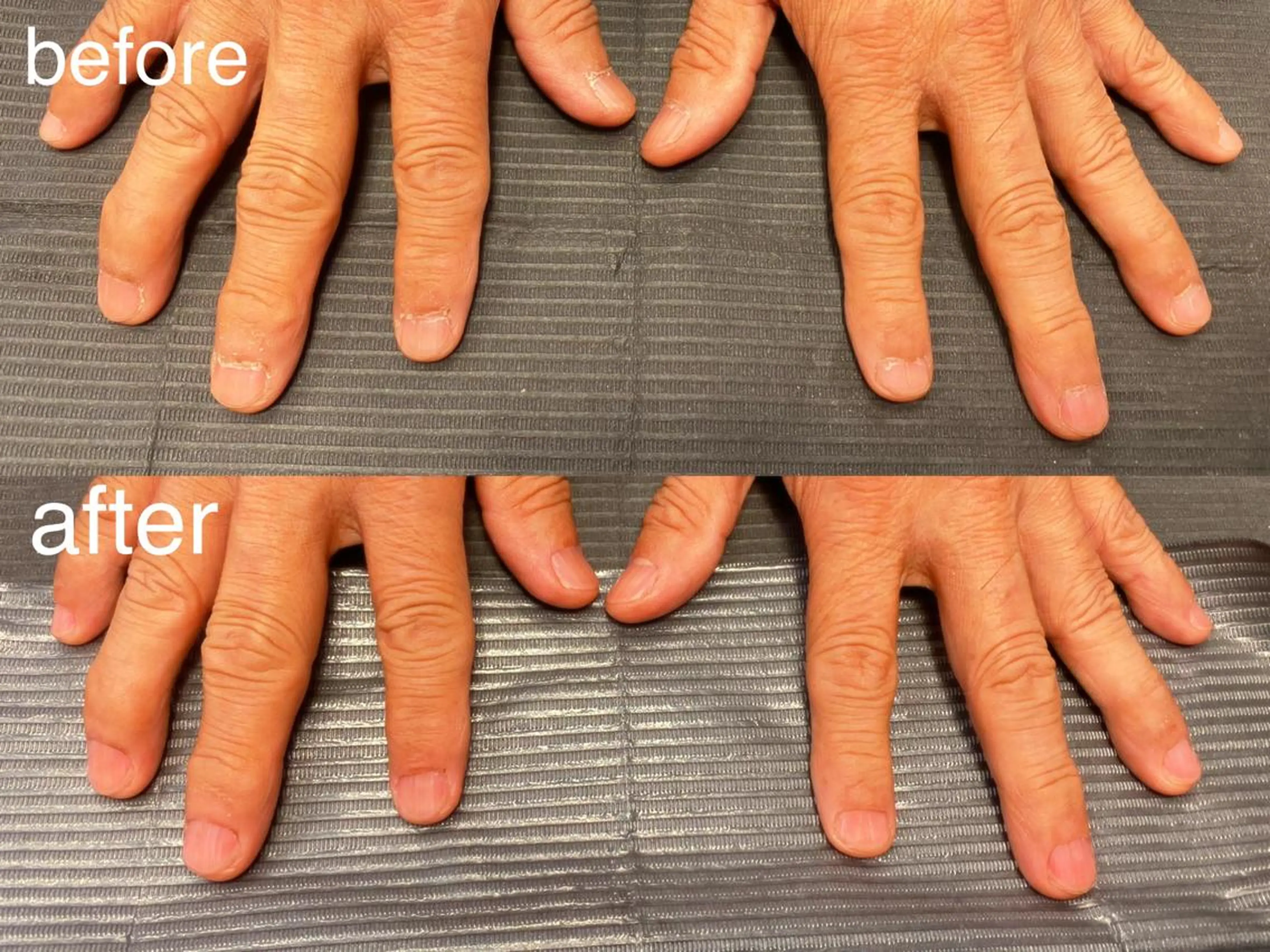 メンズネイルケアの写真