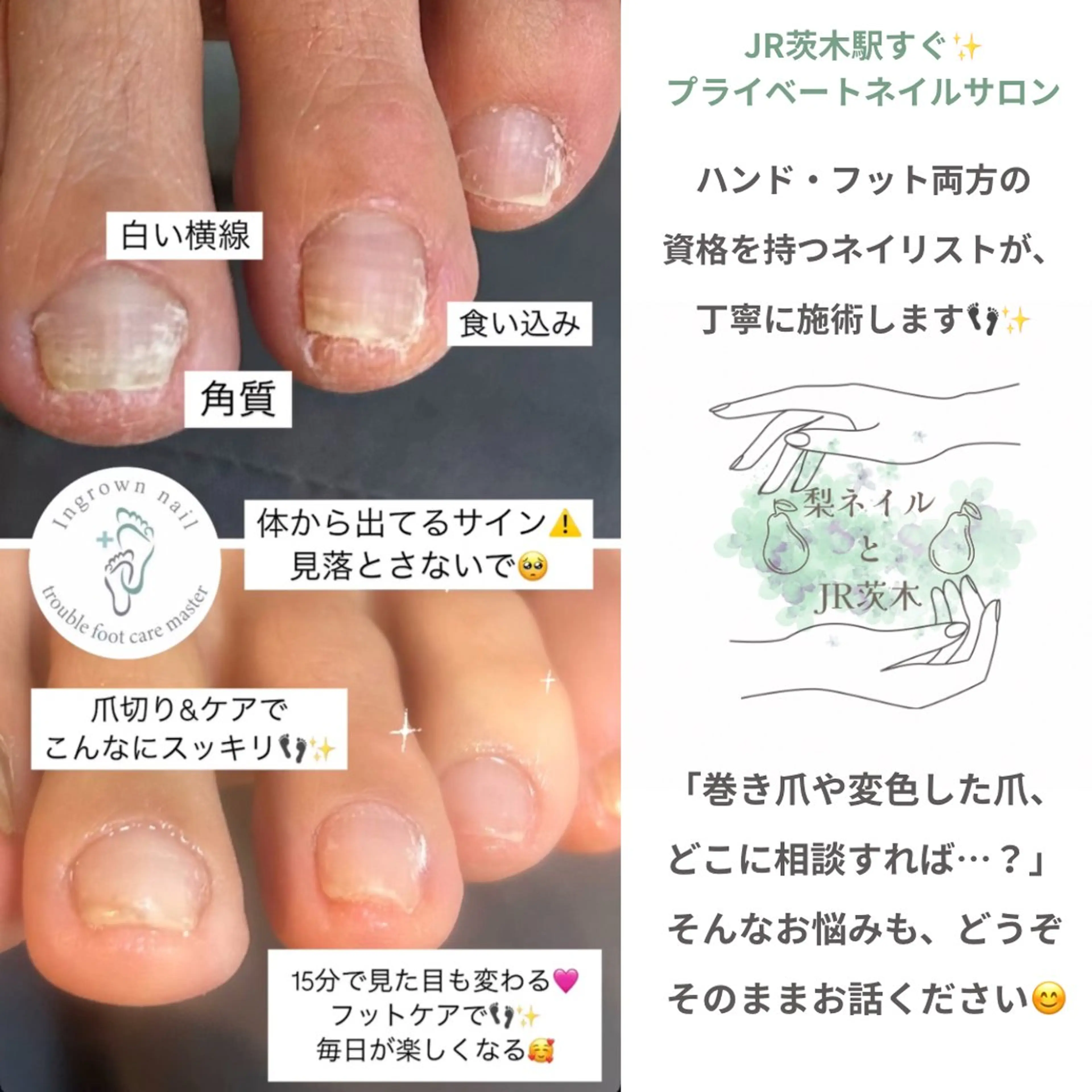 ネイル フットネイル 梨ネイルとJR茨木所属・井上 愛梨のネイルデザイン