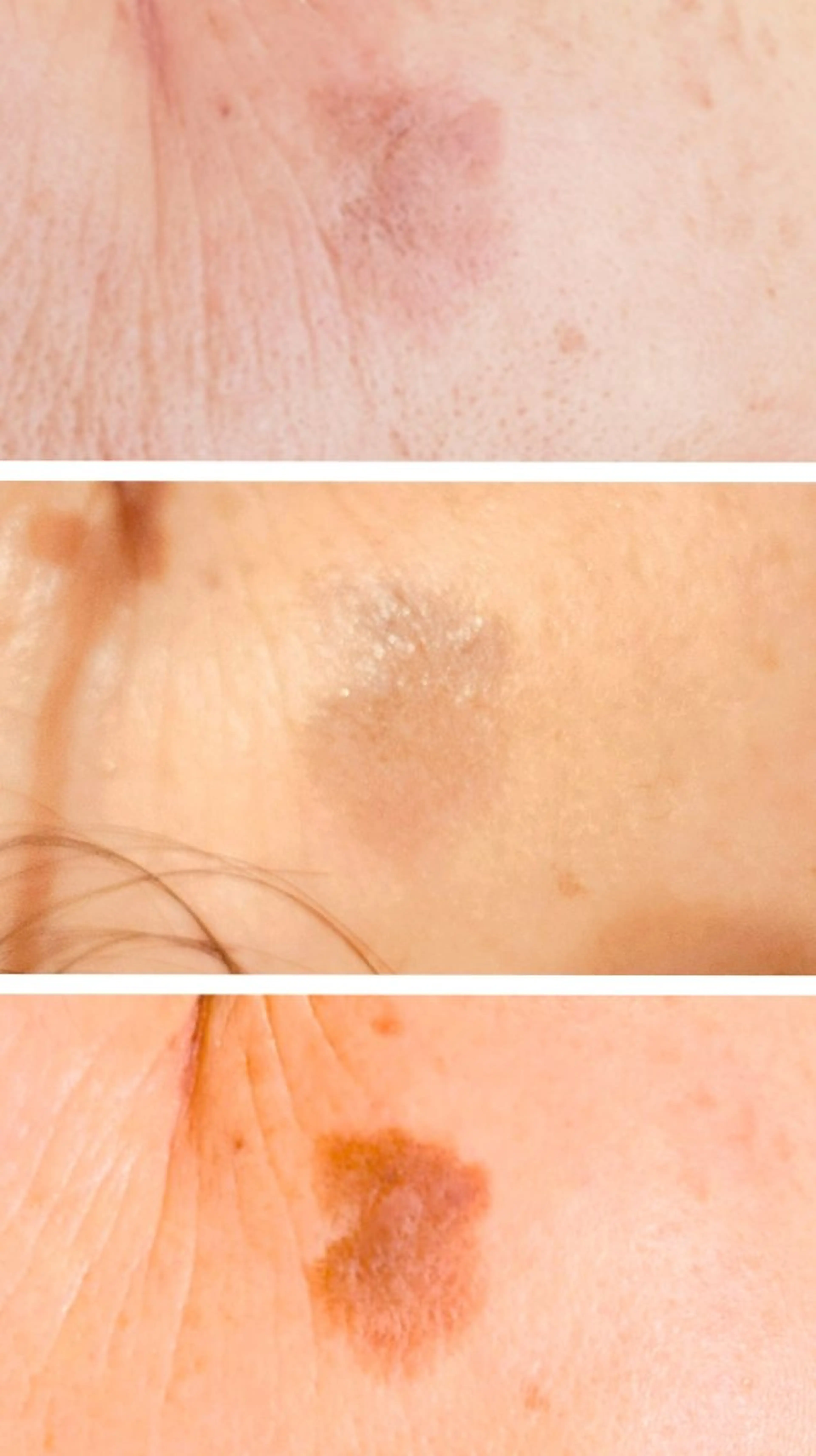 オトナのお悩み 【シミ】 カウンセリング&シミケア 60分10,000円 8,500円の写真