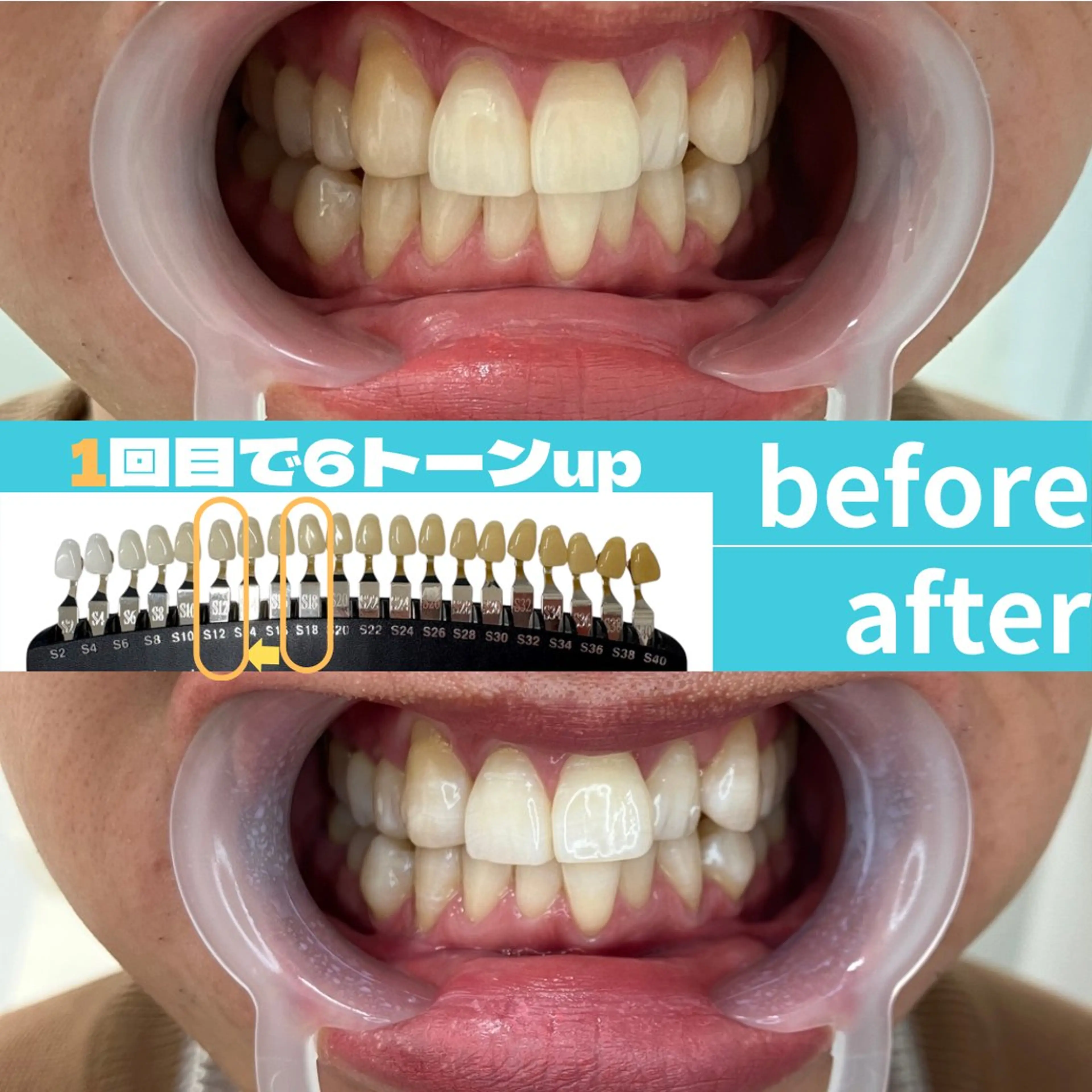 エステ s rikoのエステ・リラクイメージ