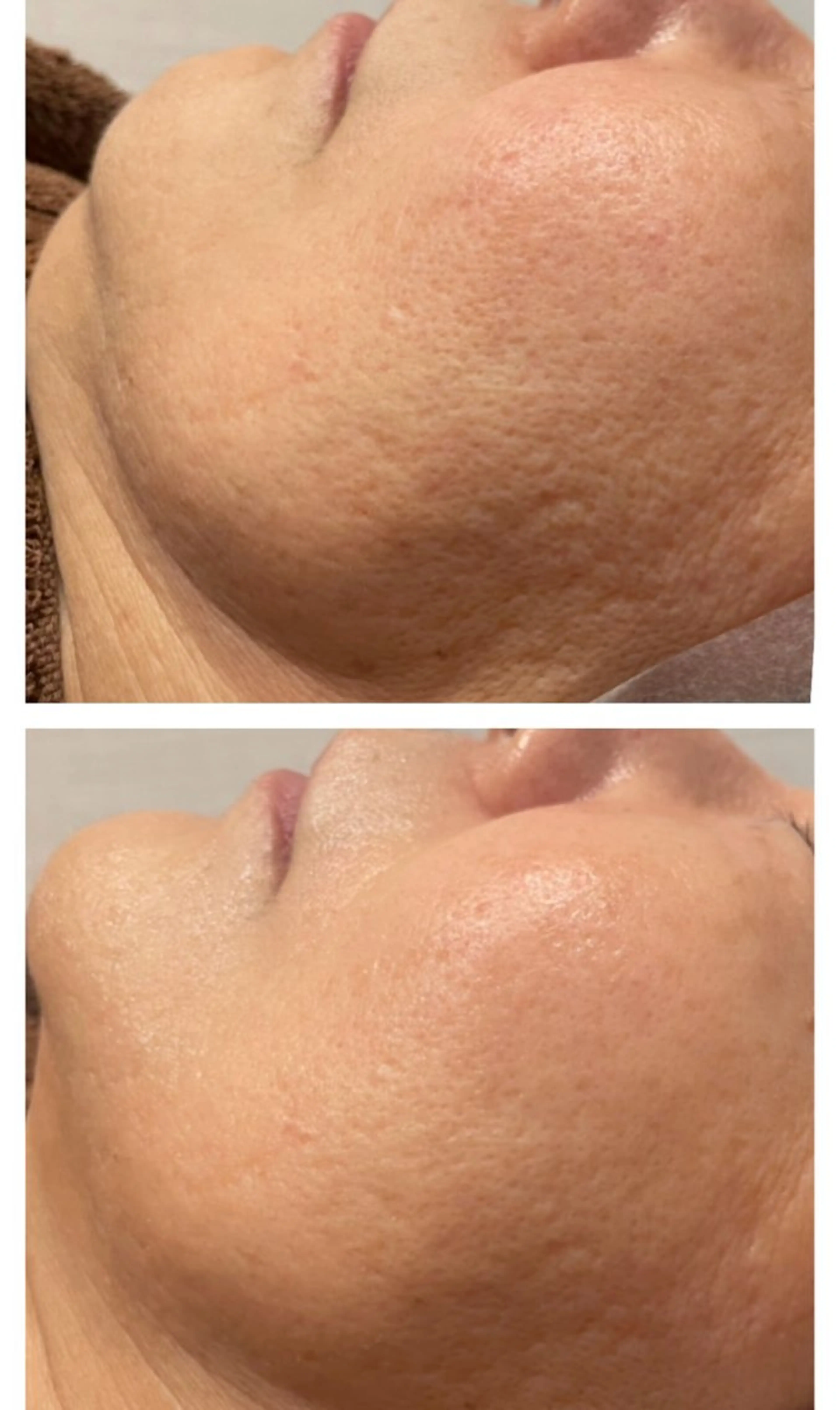 肌質改善◇結果重視 美麗-MIREI-のマツエク・マツパデザイン