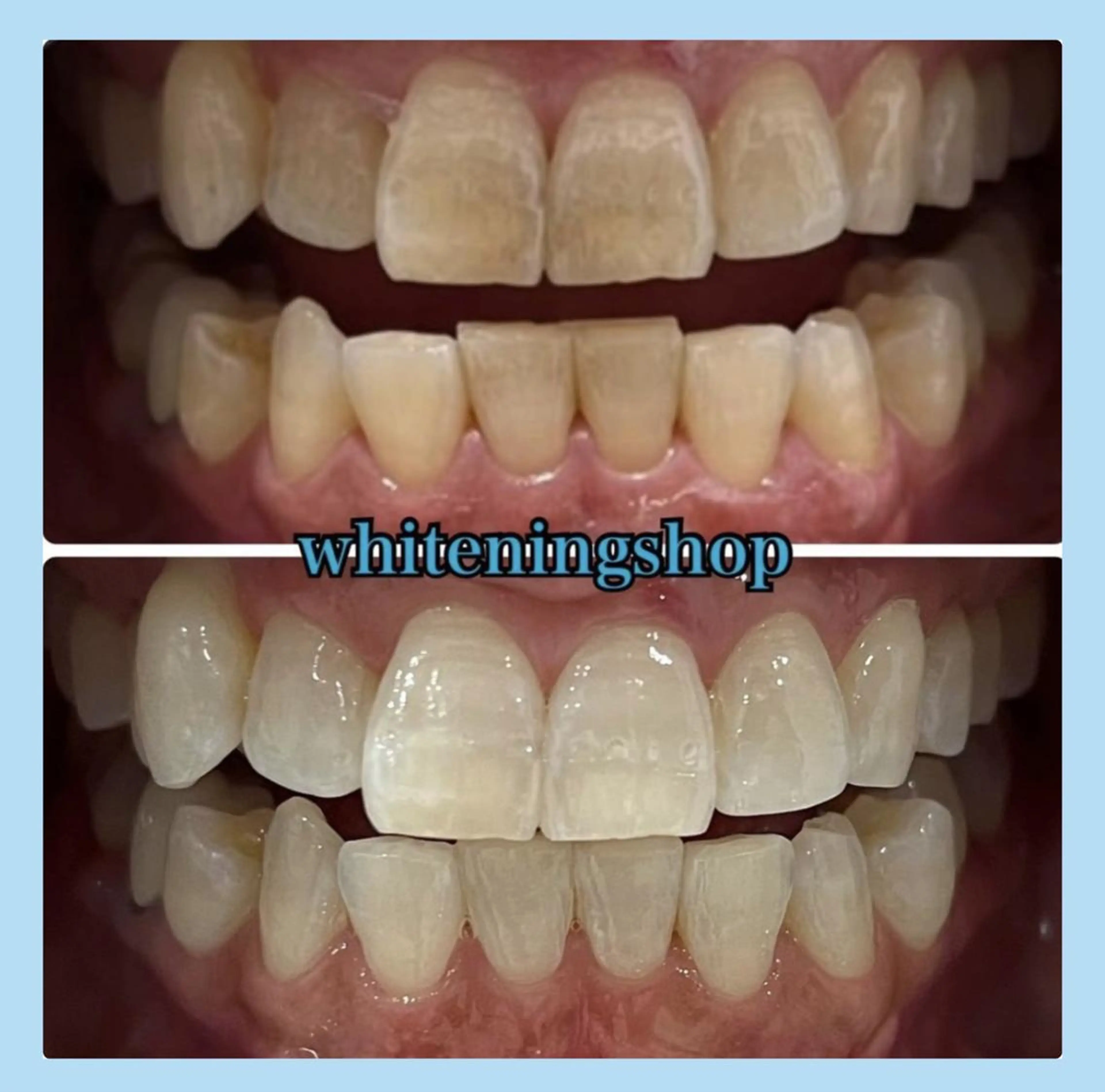 ホワイトニング ショップ千葉店のその他イメージ