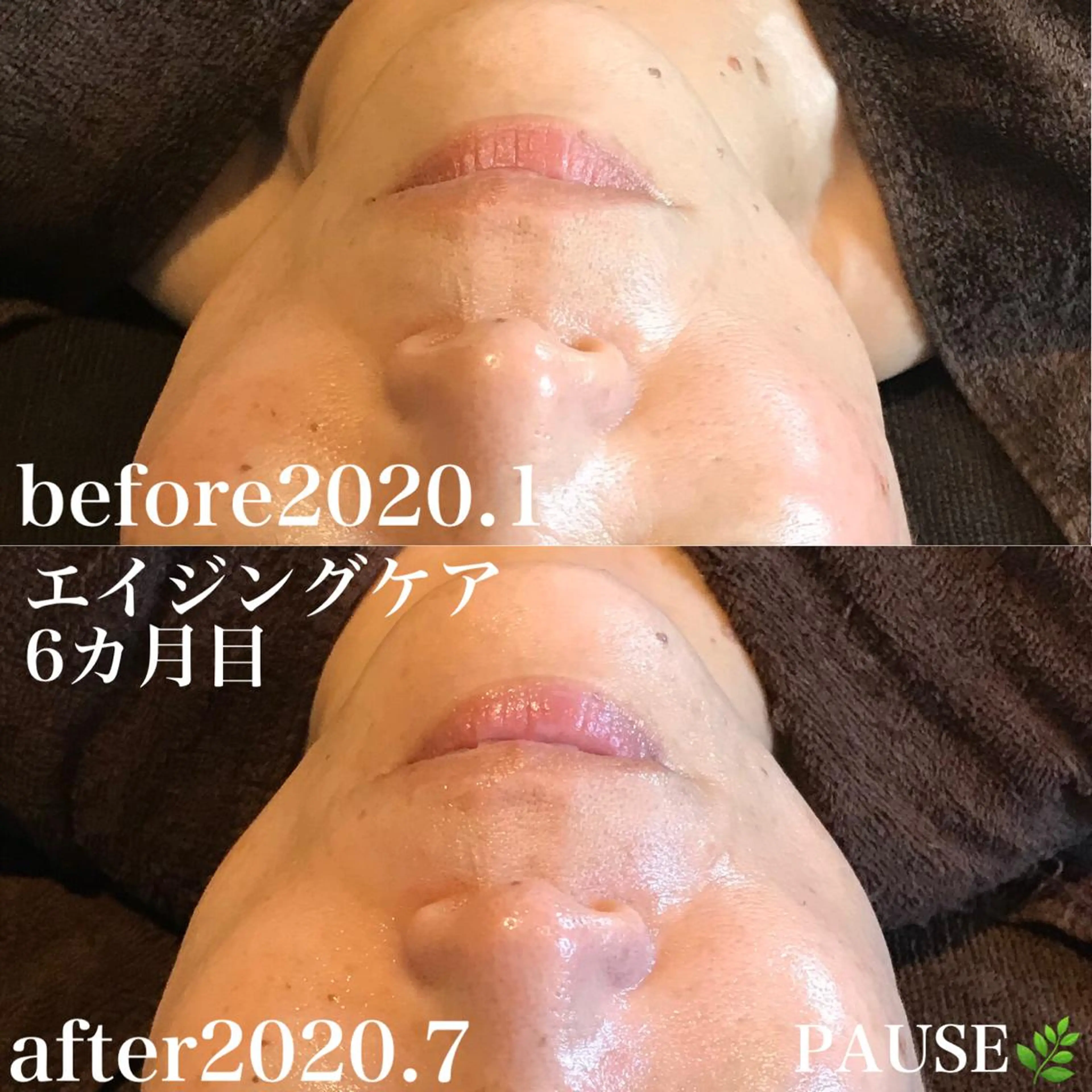 エステ 浜野 恵美のエステ・リラクイメージ