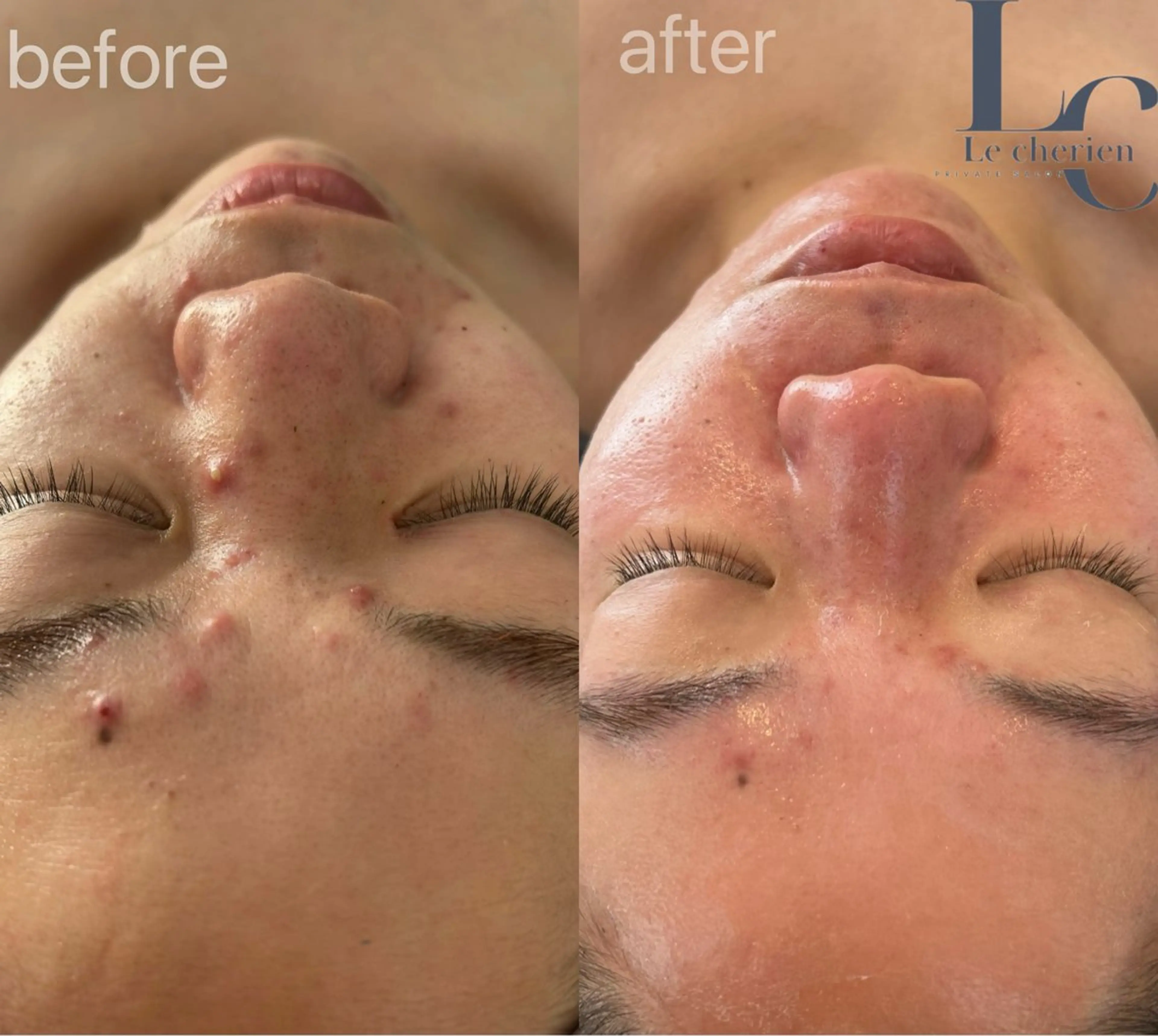 エステ Le cherienのエステ・リラクイメージ