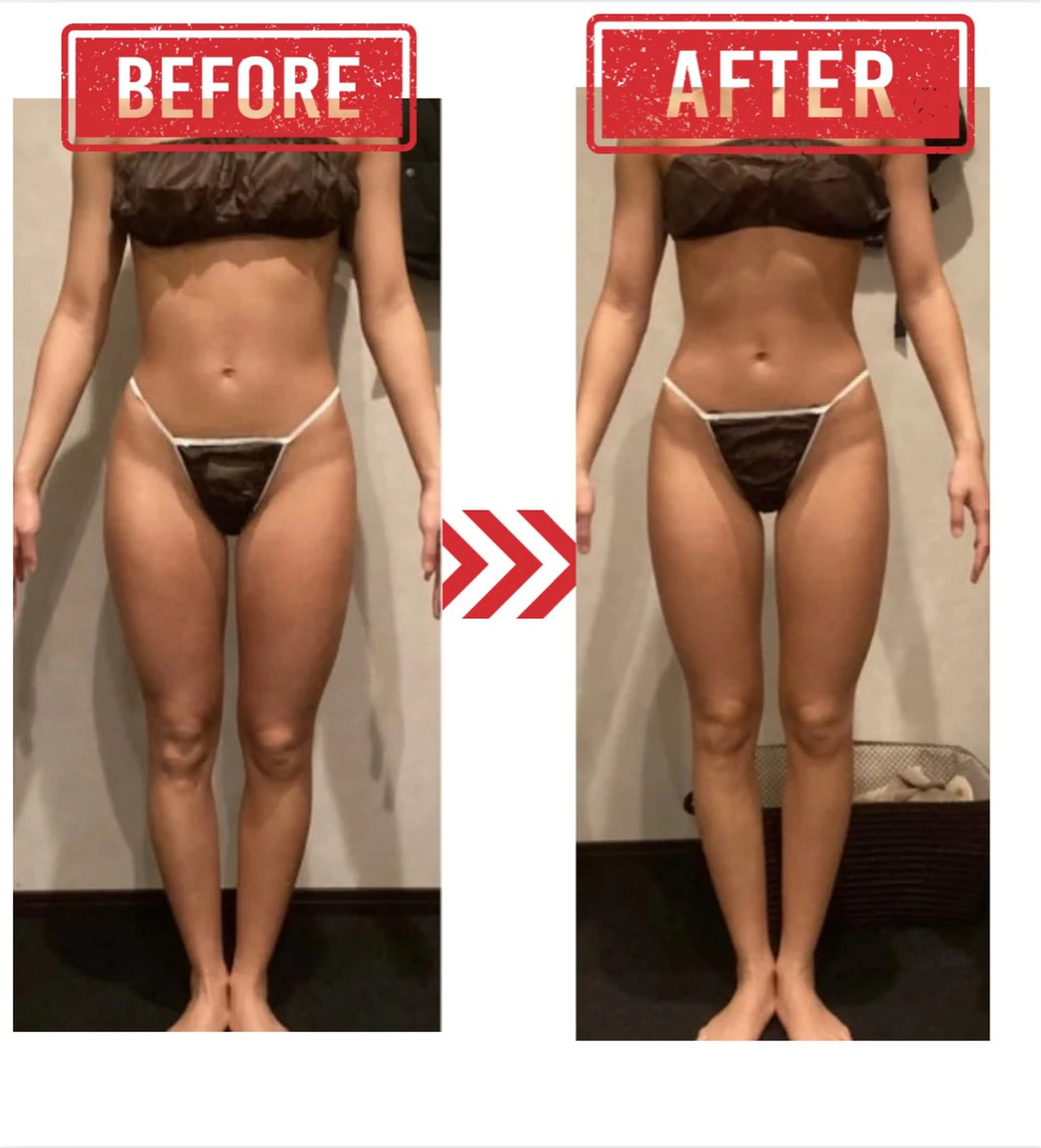 メディカルビューティーSalon Links所属・稲木 俊子のエステ・リラクイメージ