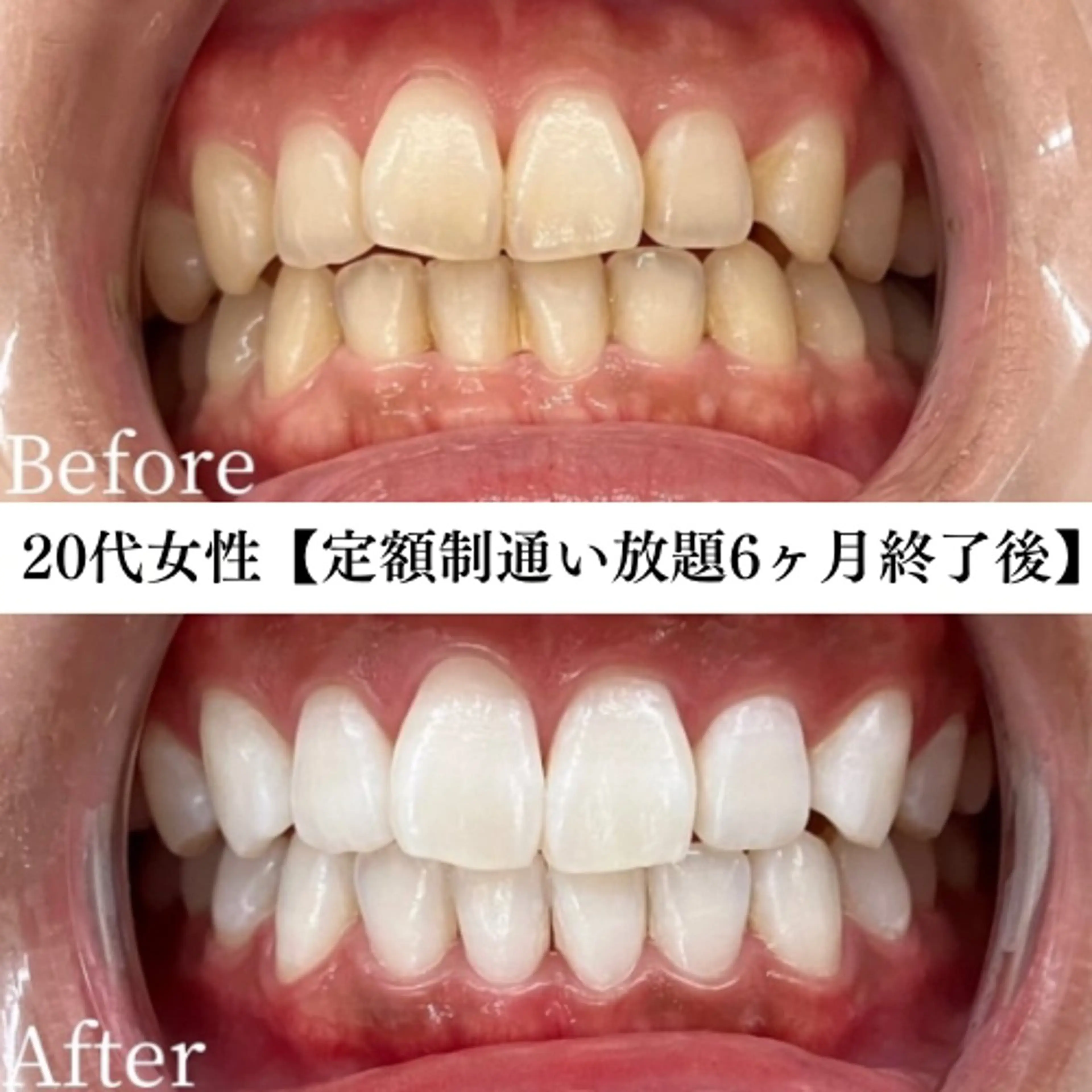 メンズ キッズ エステ リラク セルフホワイトニング専門店WHITE福岡天神店所属・セルフホワイト専門店 WHITE福岡天神店のエステ・リラクイメージ