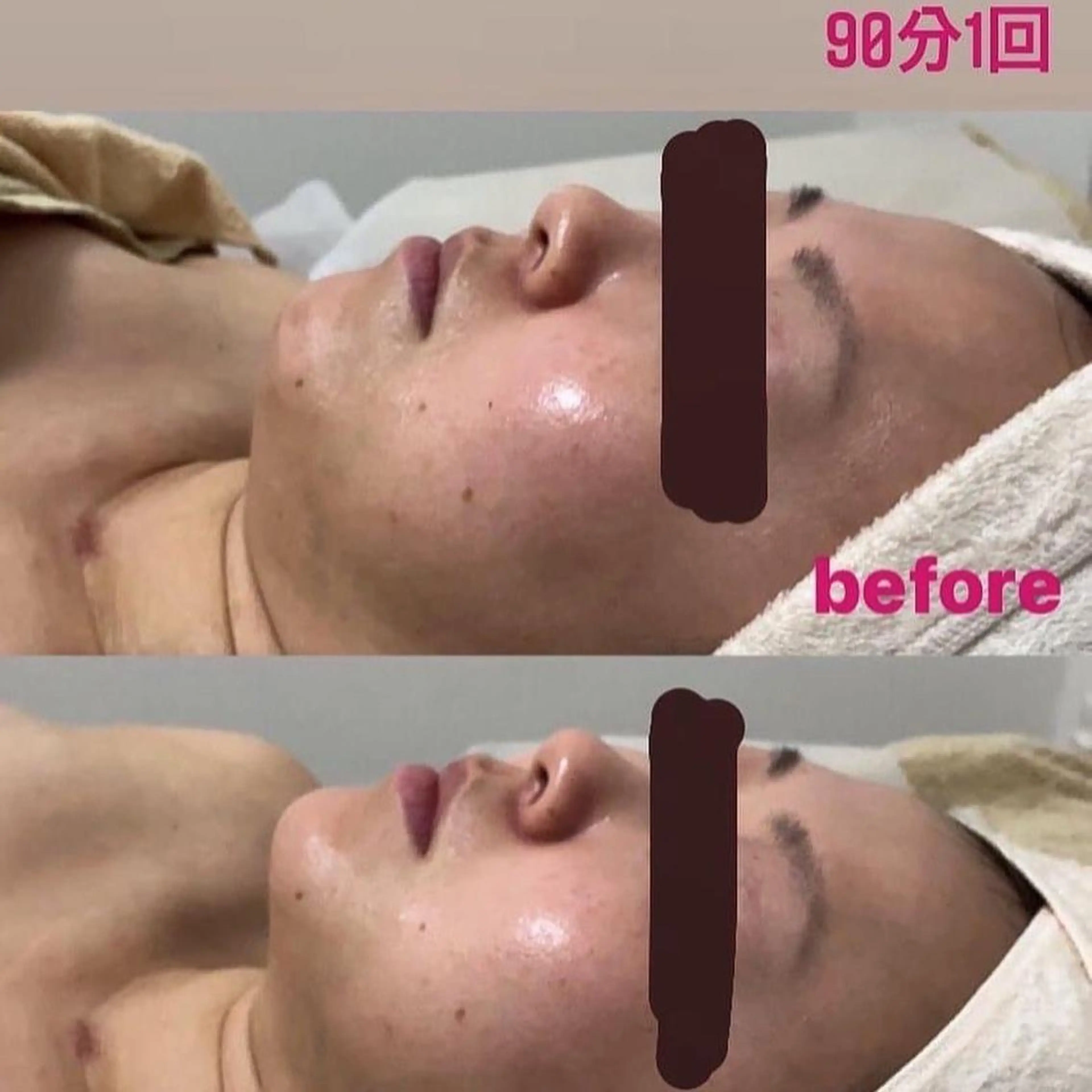 【フェイシャル＋小顔】美容整形級の立体小顔フェイシャルの写真