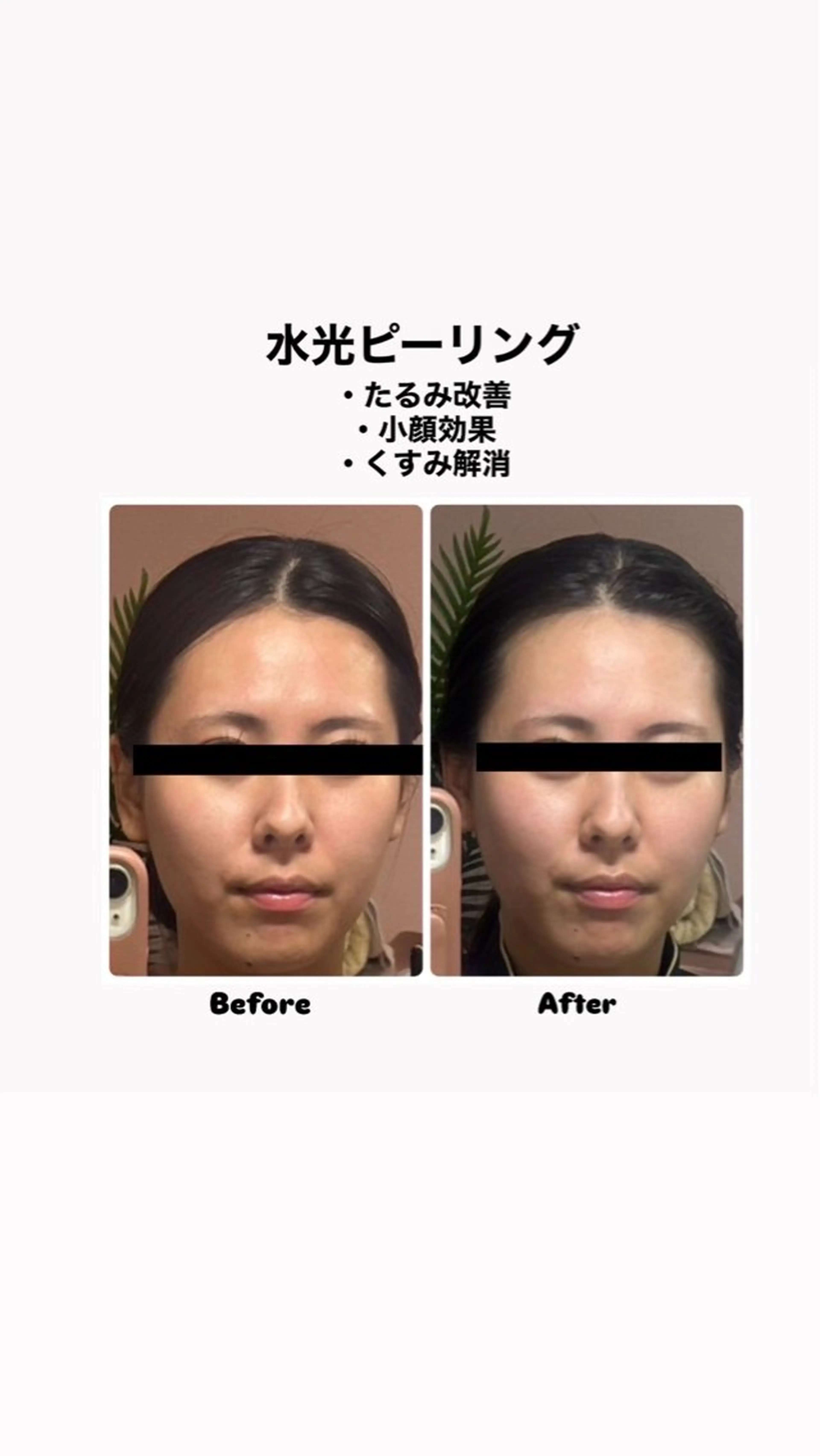 エステ リラク 脱毛サロン エクボスタッフのエステ・リラクイメージ