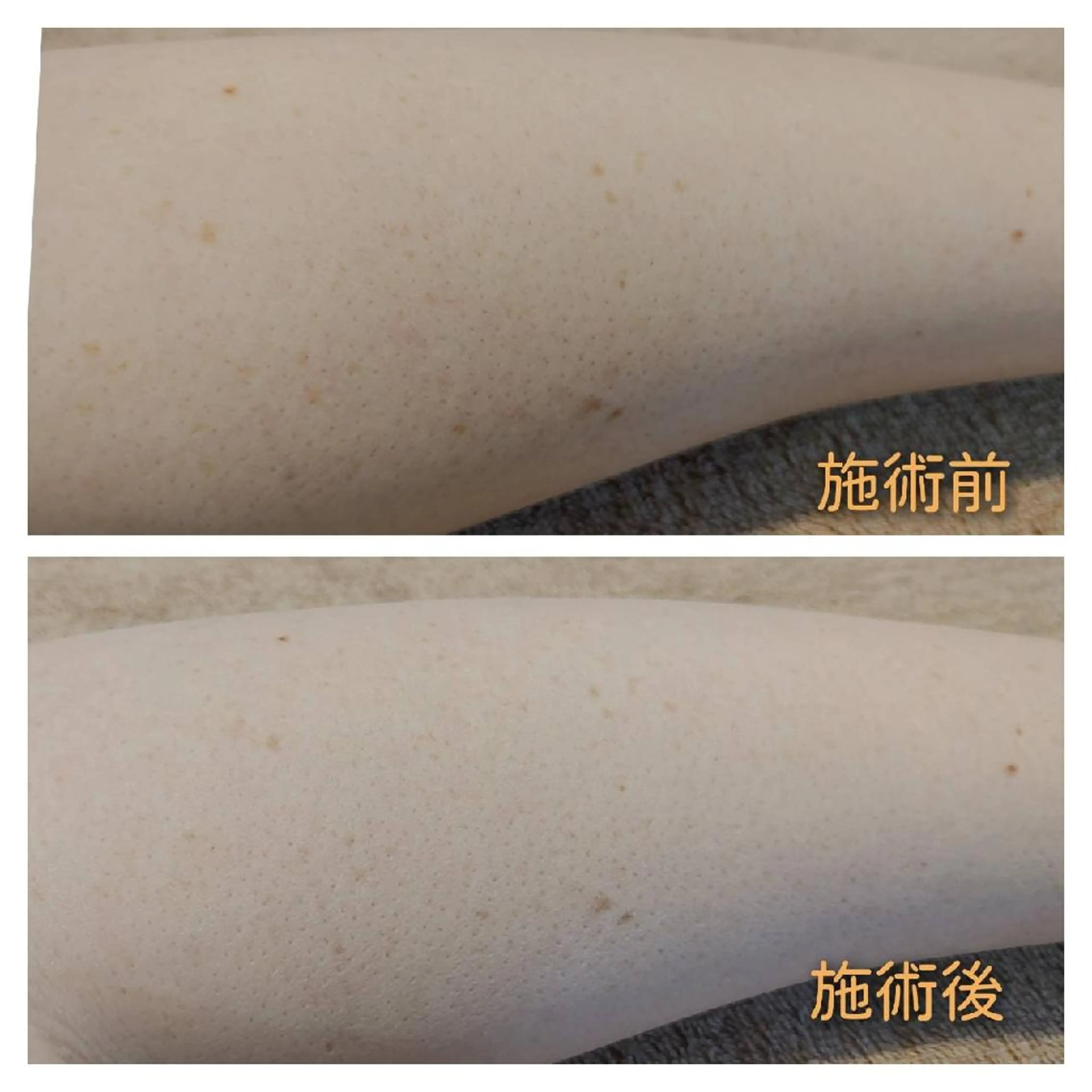 エステ viage所属・viage 脱毛&フェイシャル店のエステ・リラクイメージ