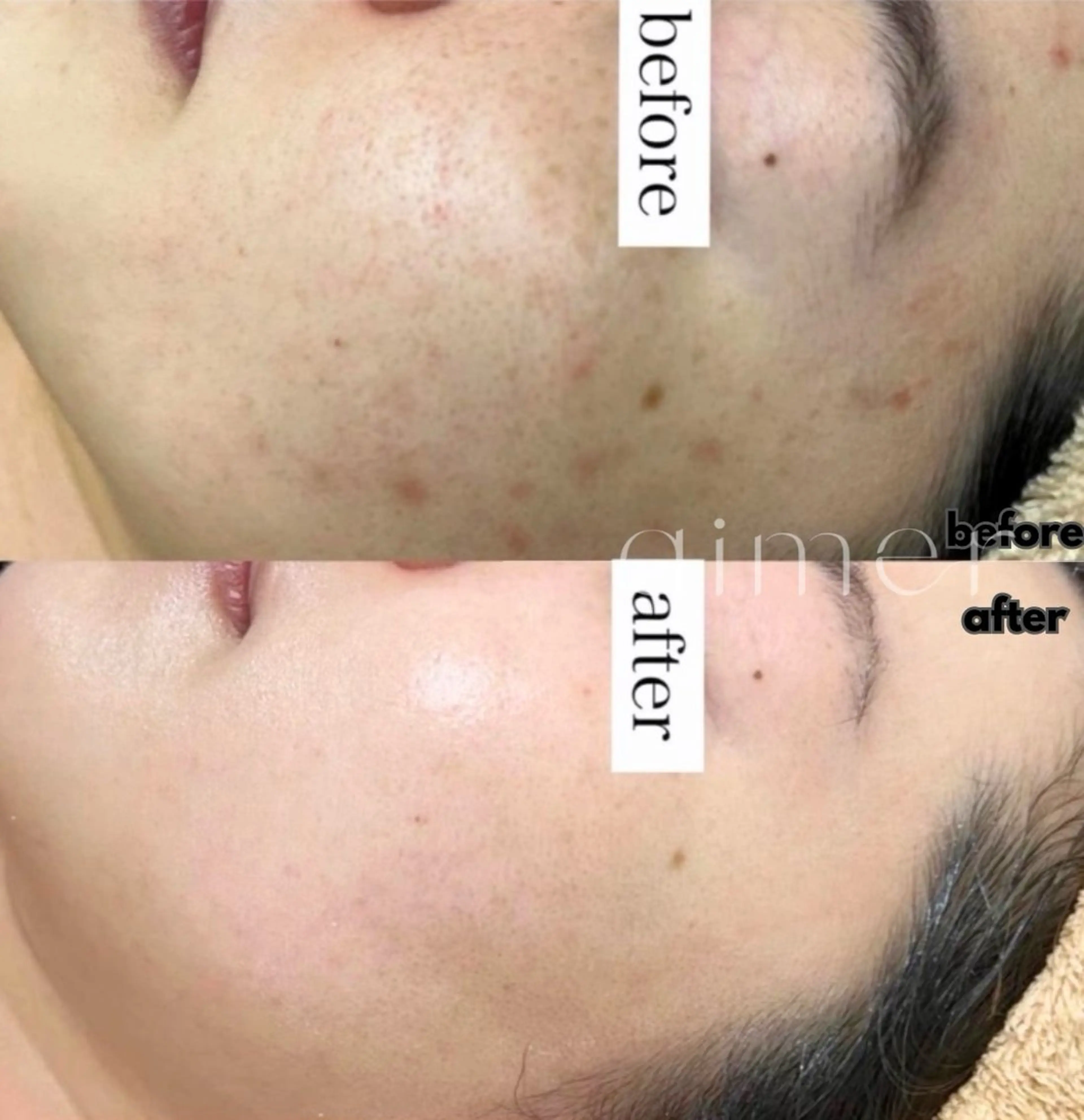 エステ aimer 栄店のエステ・リラクイメージ