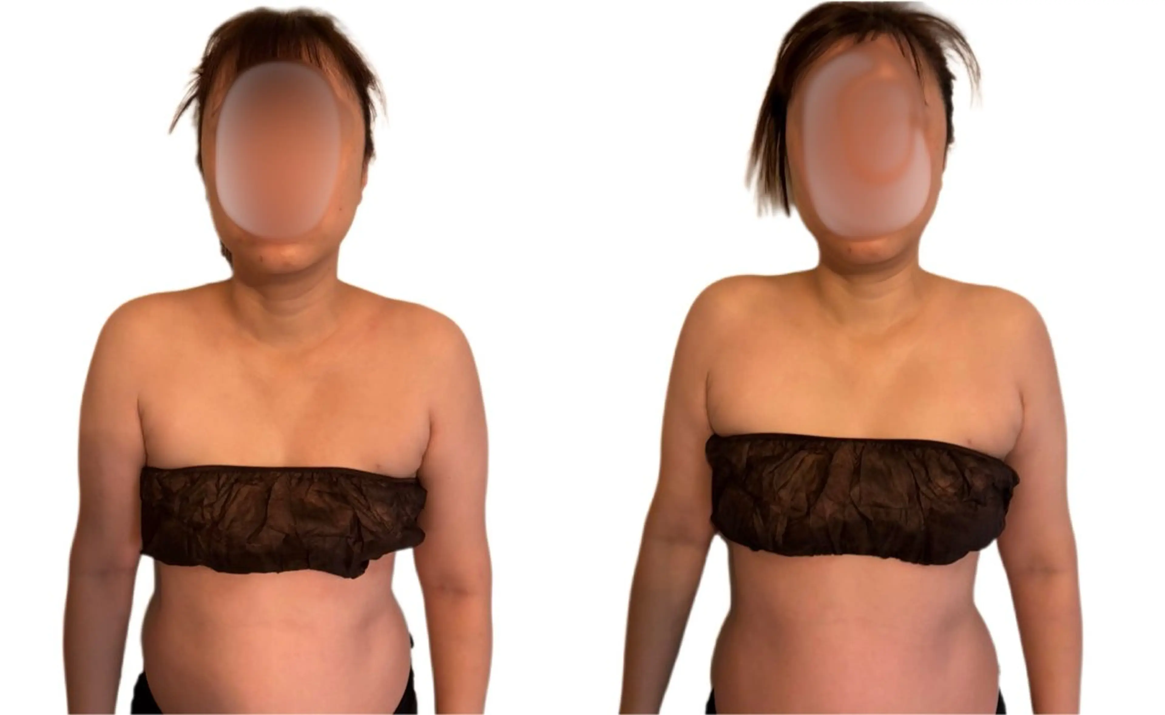 【小顔見せ×巻き肩解消】首肩デコルテ流し＋顔コルギ 50分の写真