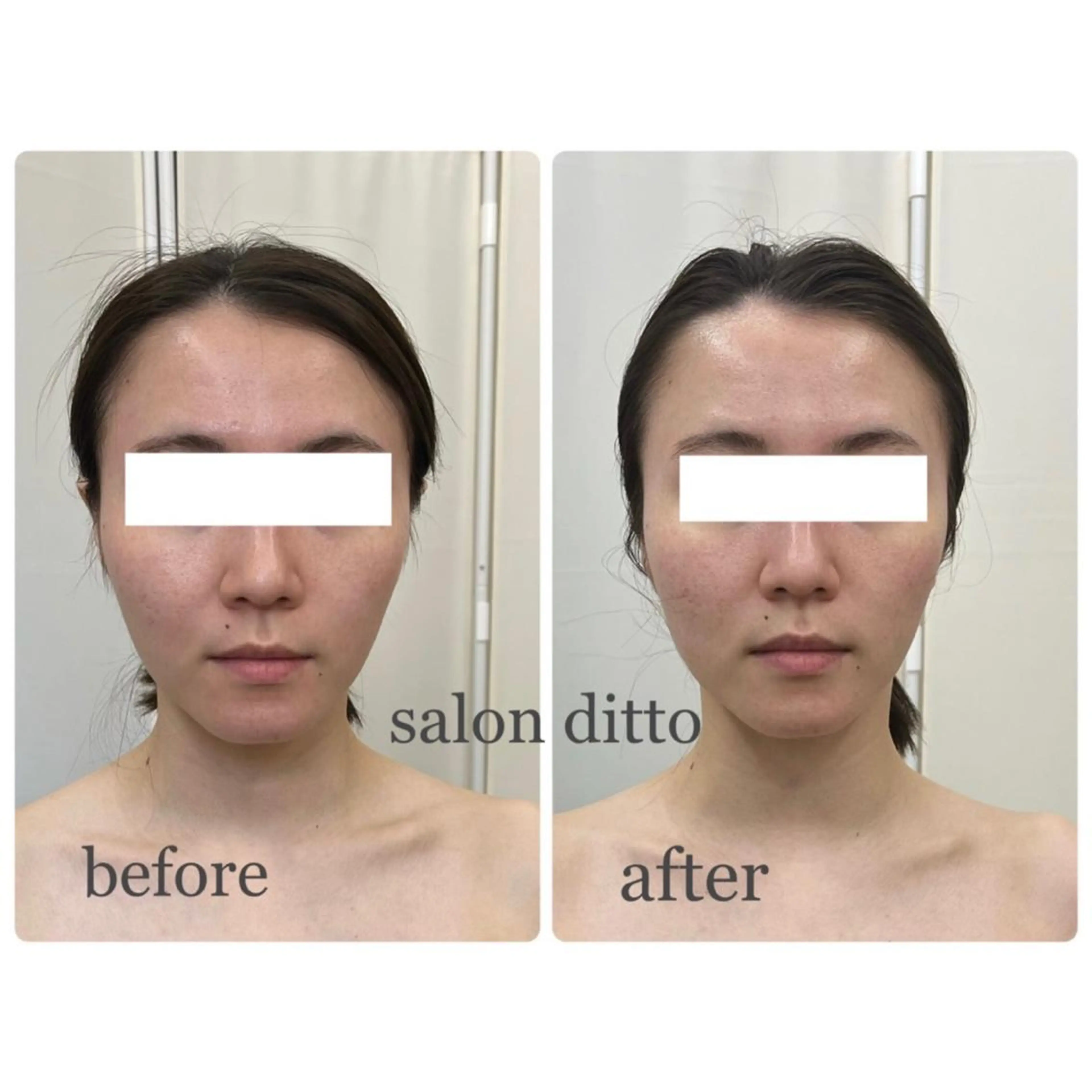 エステ リラク salon ditto所属・mio (小顔・ヘッドスパ)のエステ・リラクイメージ