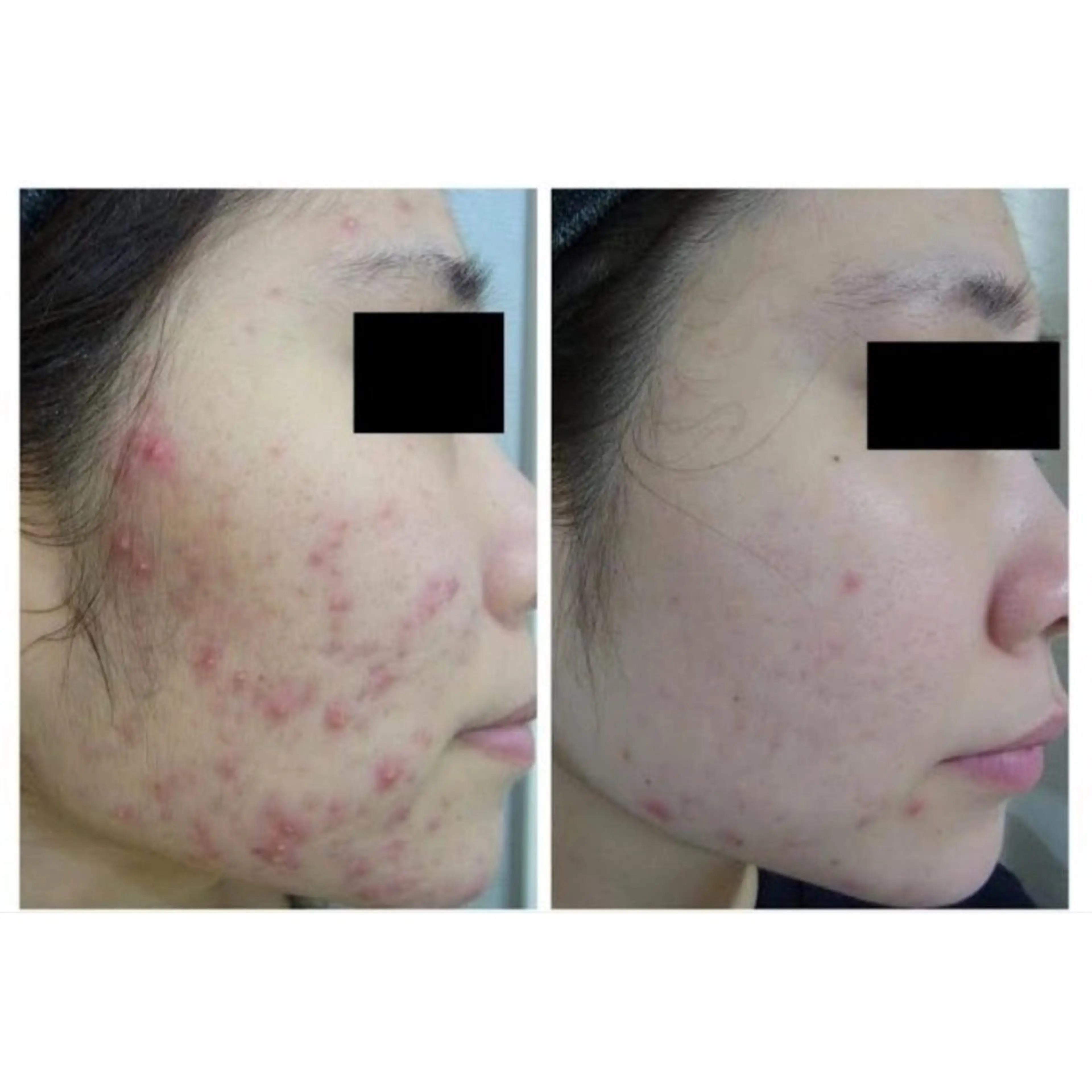 肌質改善専門サロン 川島 彩のエステ・リラクイメージ