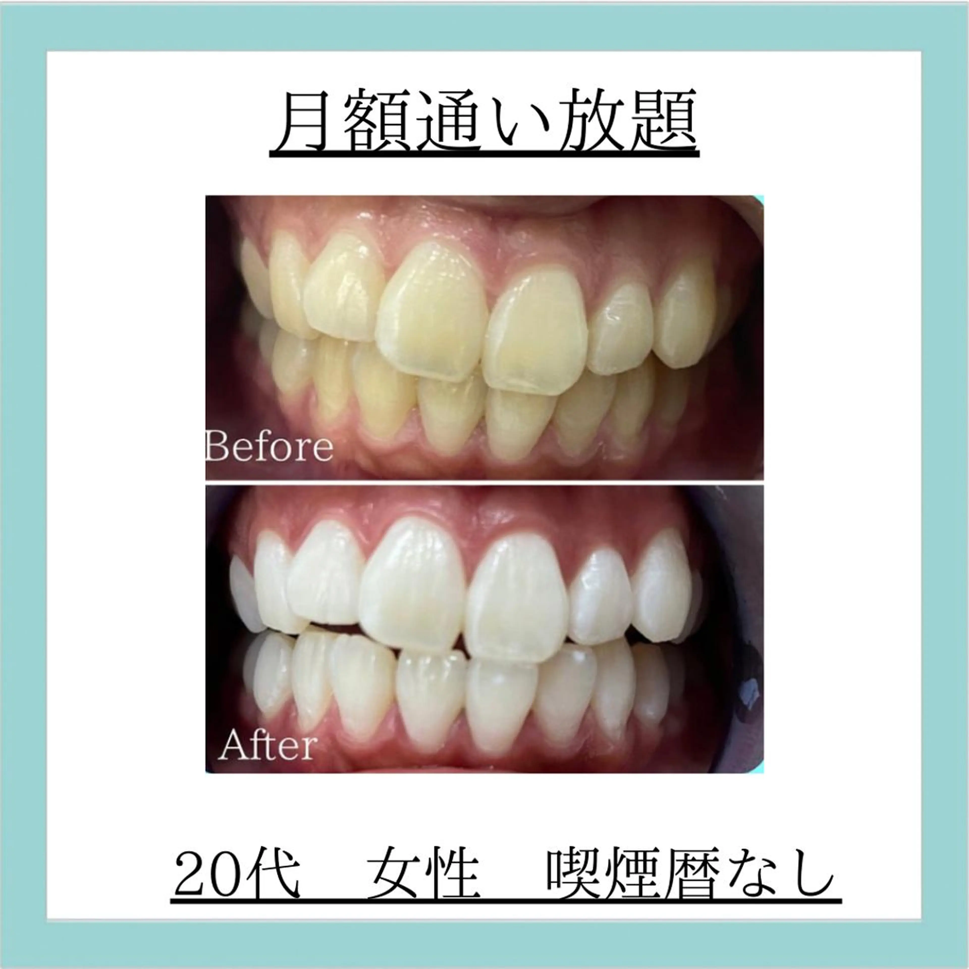 月額通い放題&回数券のお客様の写真