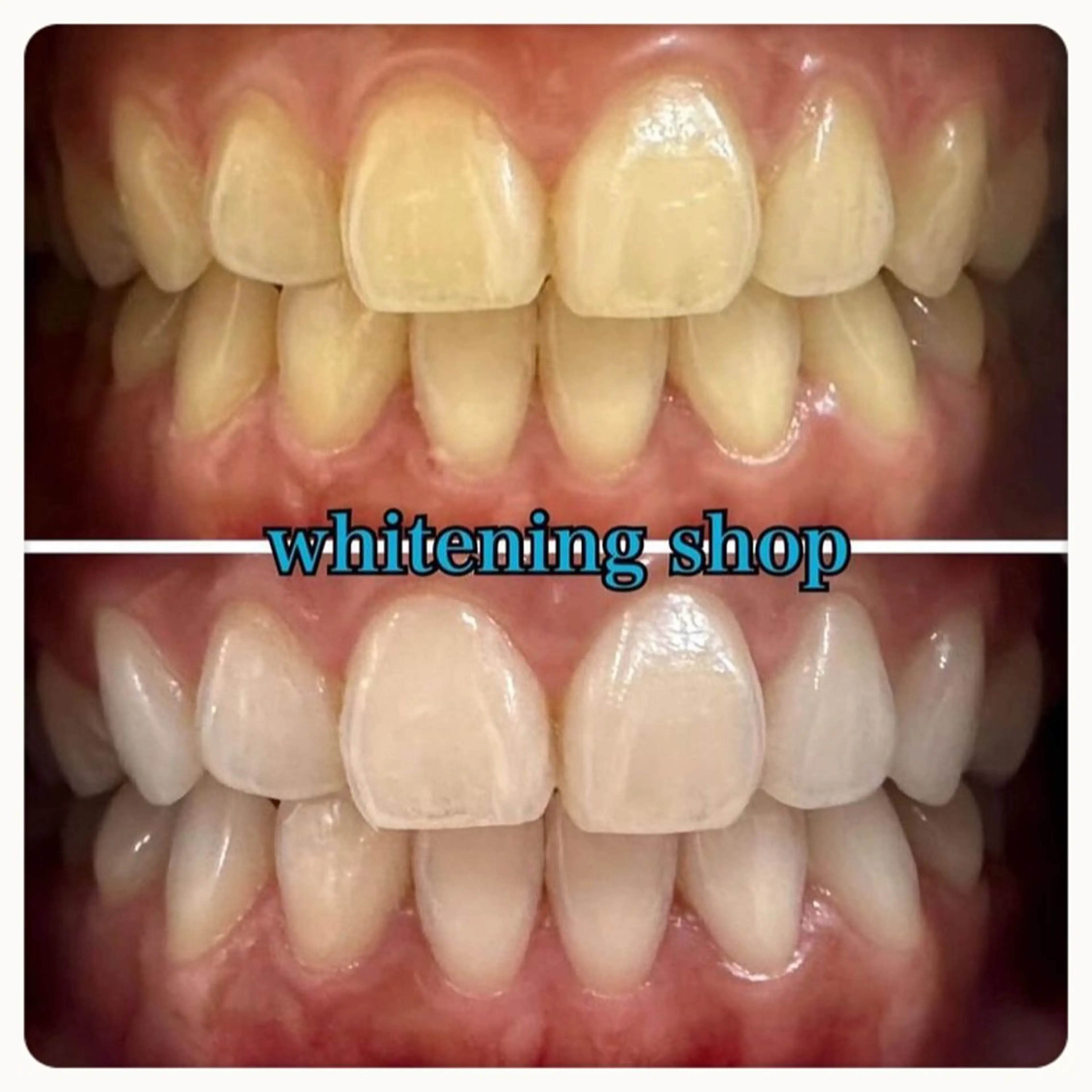 エステ リラク ホワイトニング ショップ吉祥寺店のエステ・リラクイメージ