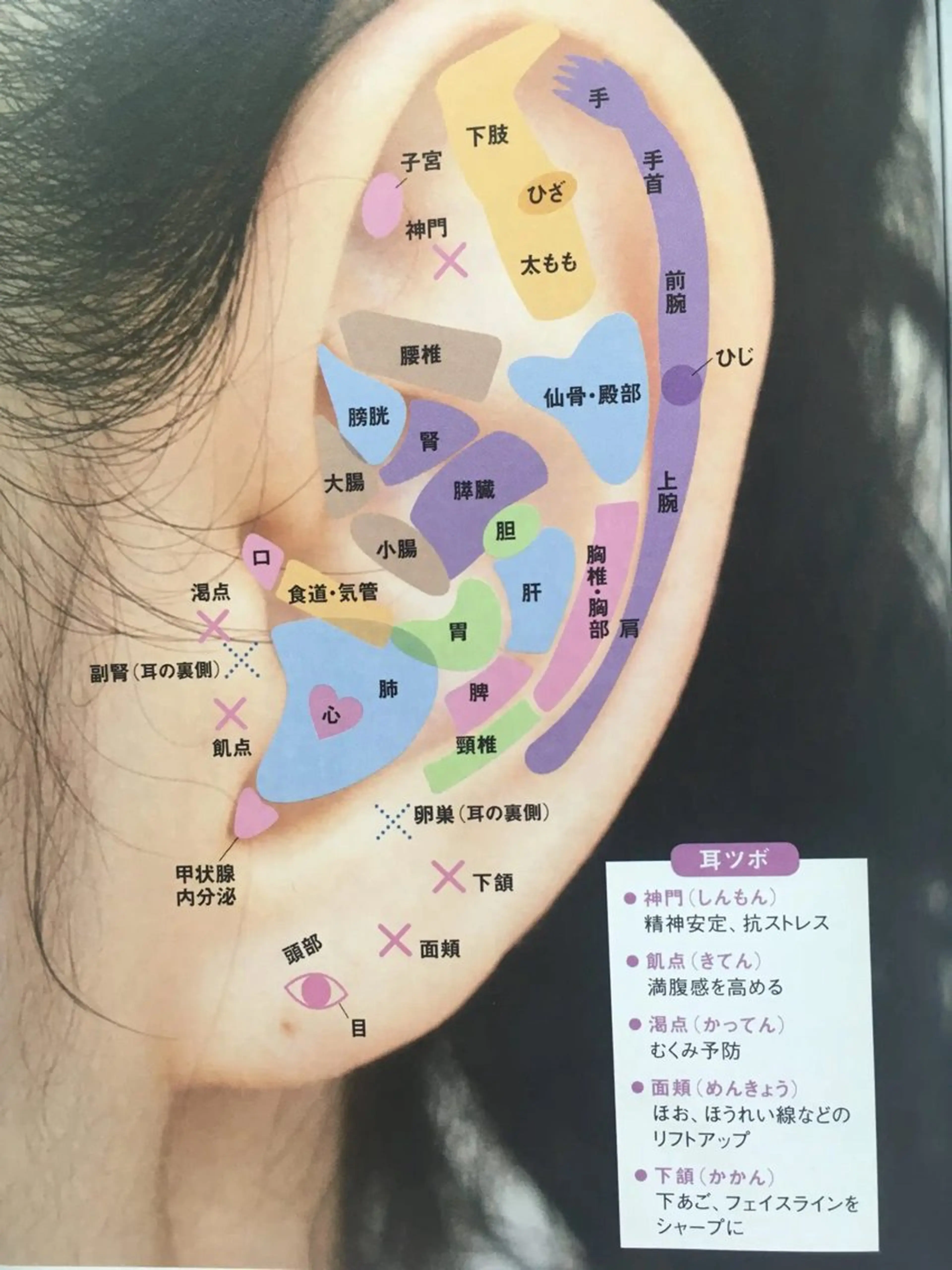 美楽鍼 びらくしんのその他イメージ