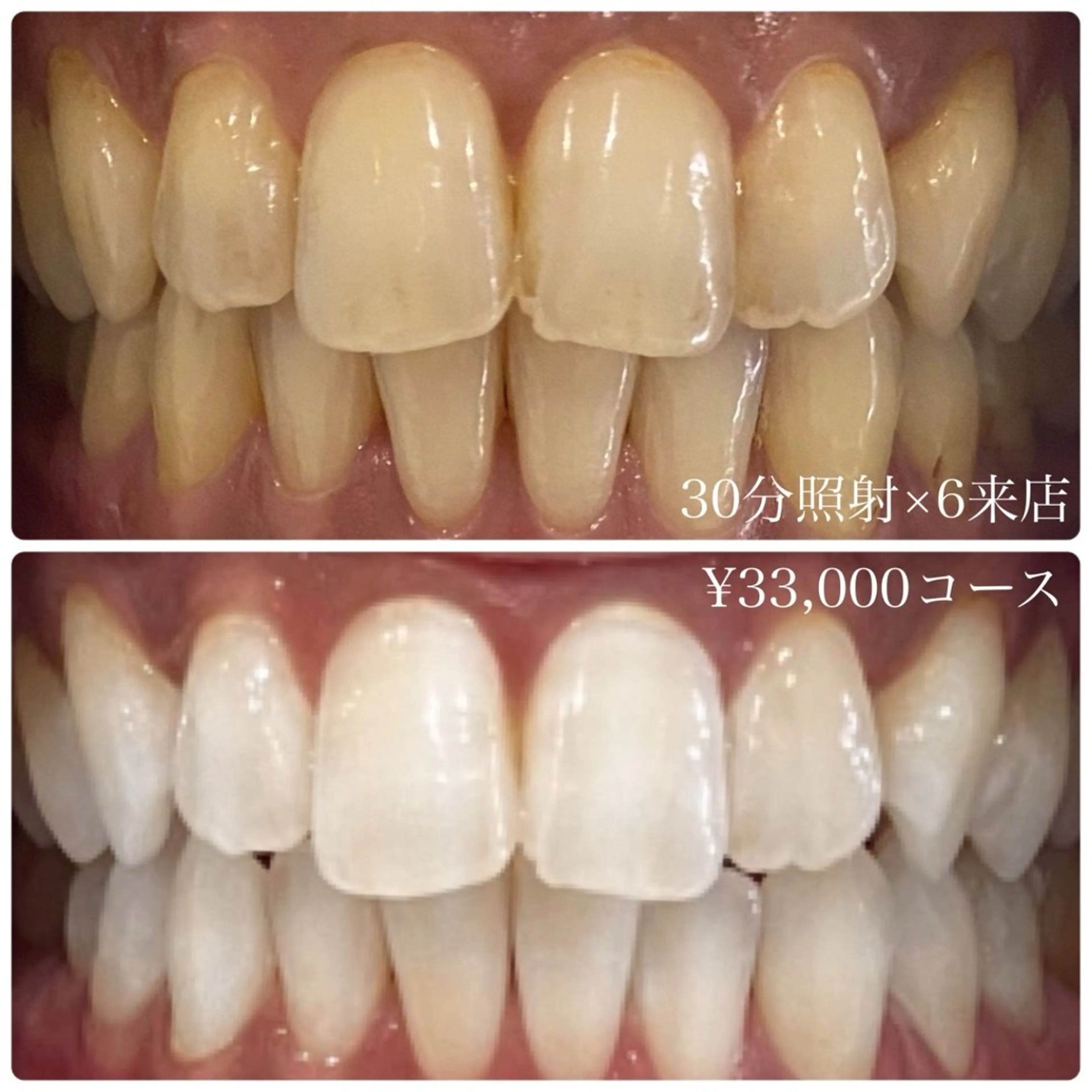 PLATINUM Beauty 横浜店所属・ホワイトニングルーム 横浜店のその他イメージ