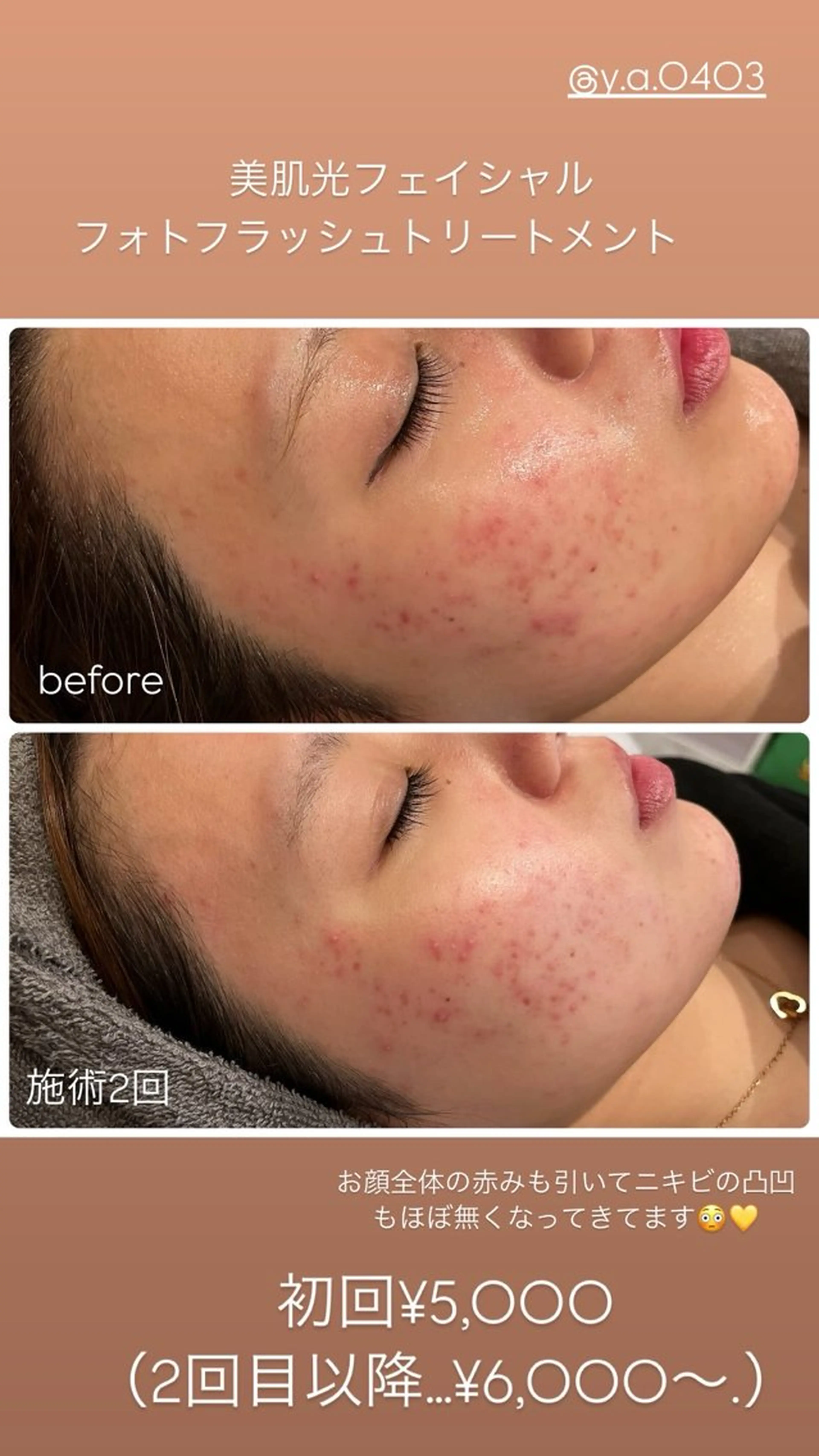 エステ yellow.所属・yellow💛【 脱毛&フェイシャル】のエステ・リラクイメージ