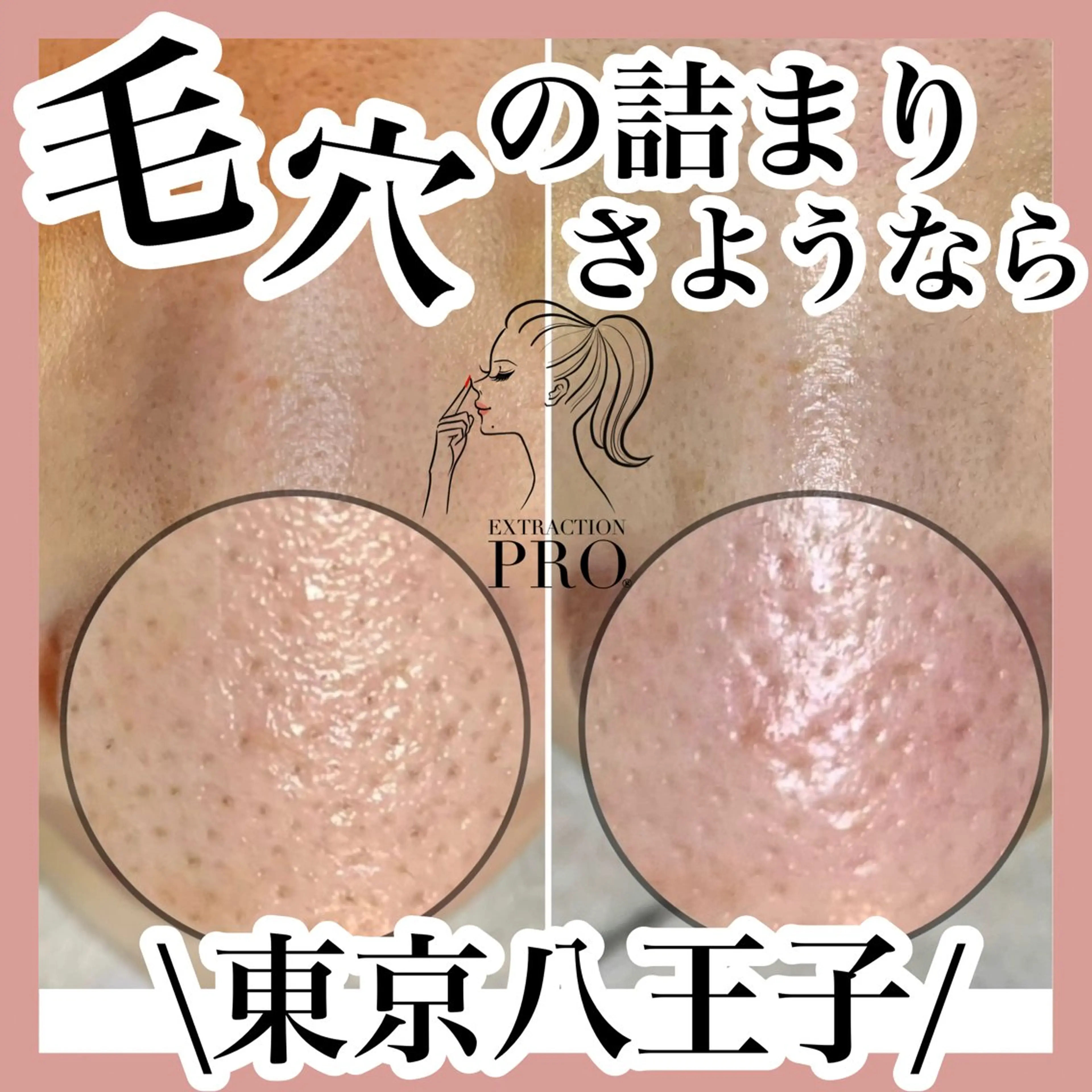 エステ 毛穴肌育専門店 リールのエステ・リラクイメージ