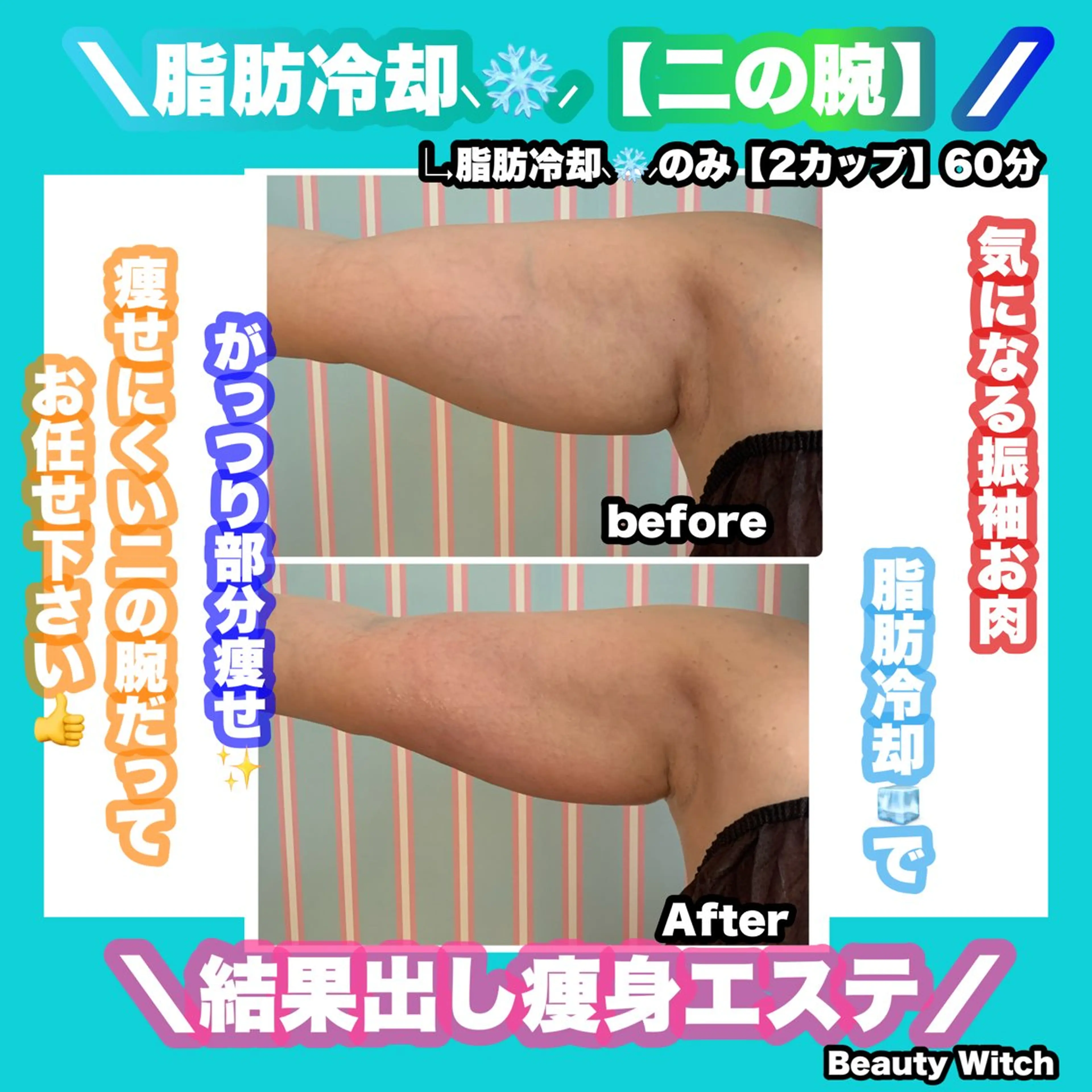 エステ リラク 痩身/脱毛/ネイル HARUKAのエステ・リラクイメージ