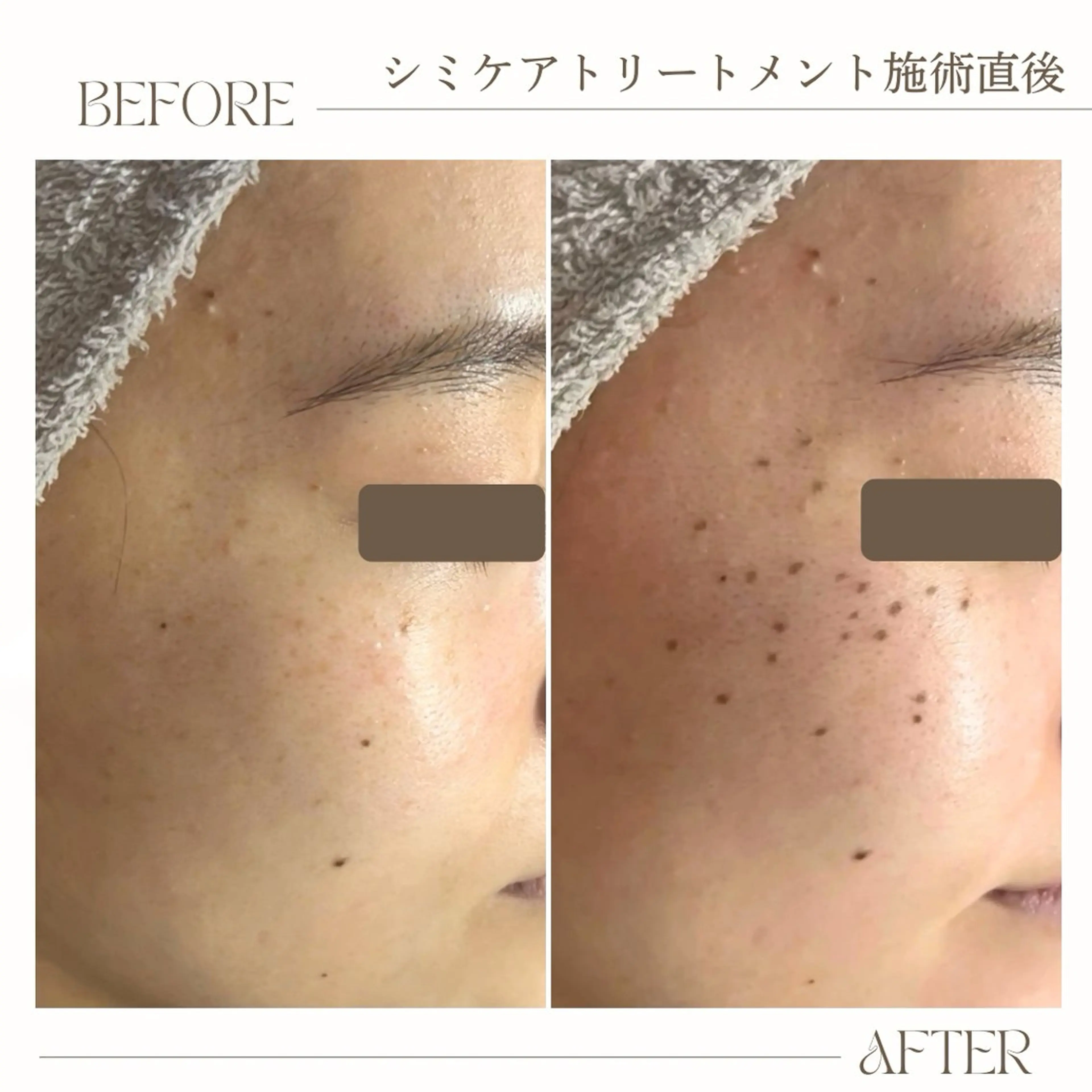 シミ・肌育サロン Jullyのエステ・リラクイメージ