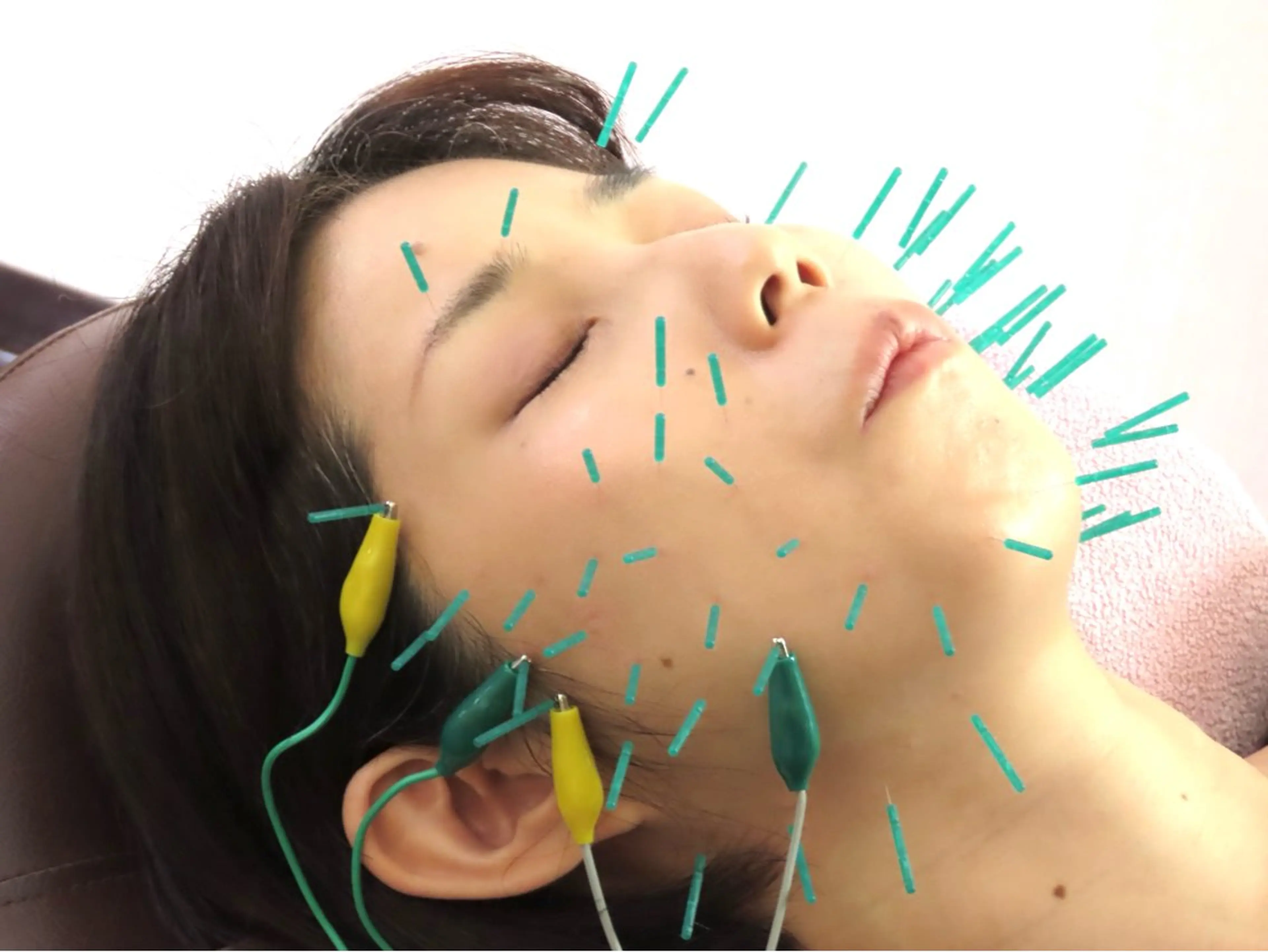 エステ リラク 中村 峻也(鍼灸師)のエステ・リラクイメージ