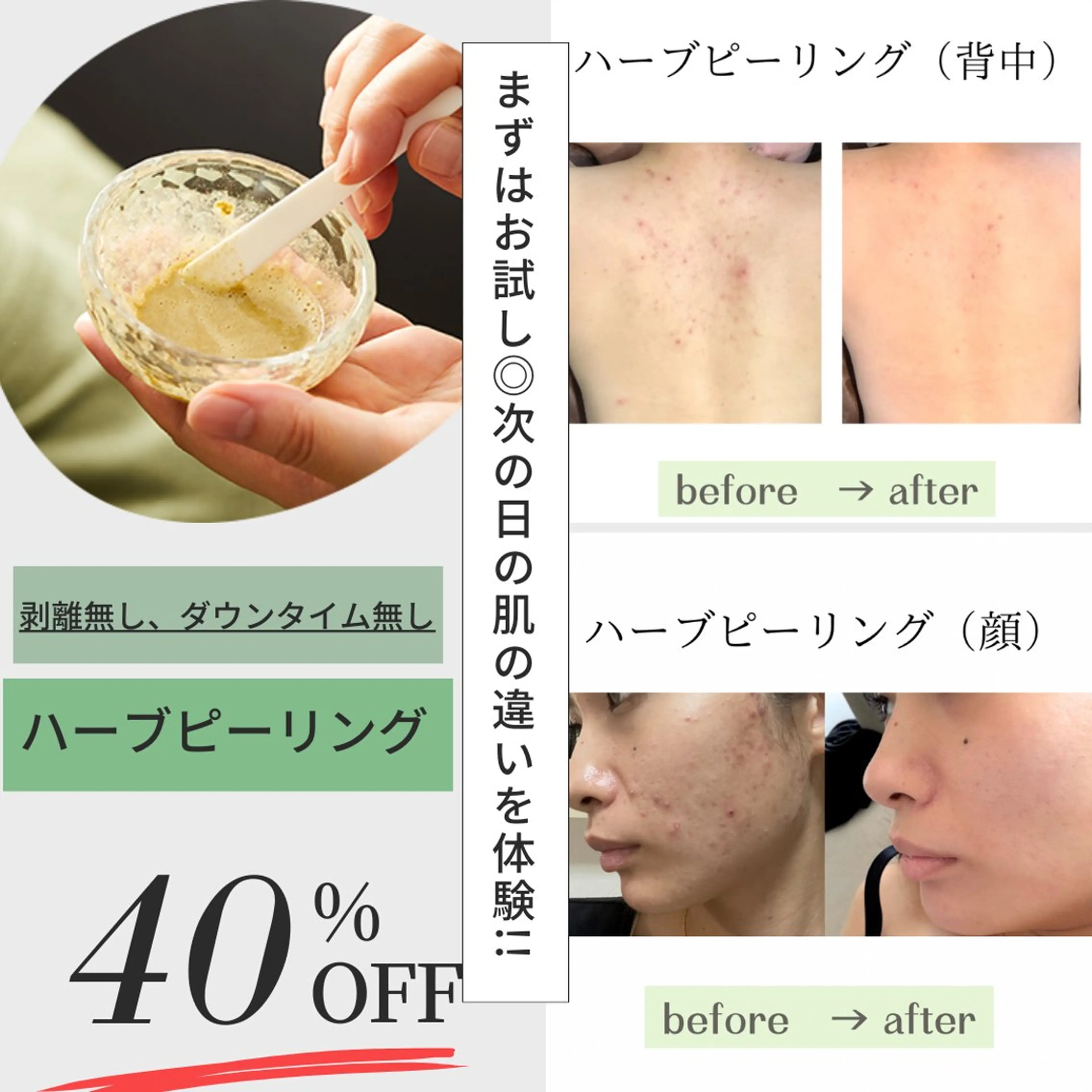 エステ 💠mariange💠(脱毛・ハーブピーリング)所属・mariange 〜美肌・美容脱毛〜のエステ・リラクイメージ