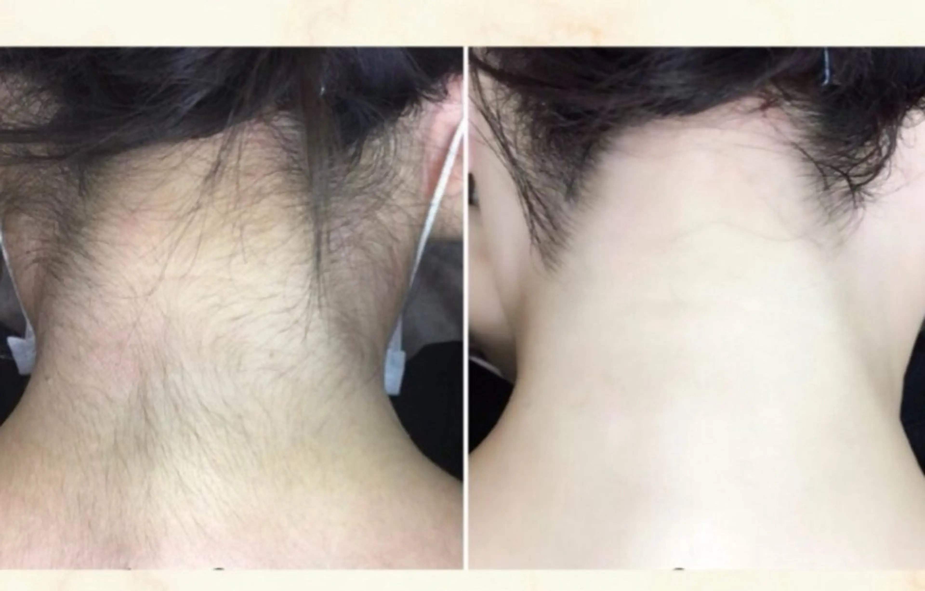 脱毛 脱毛専門減毛サロン LULU.tokyoのエステ・リラクイメージ