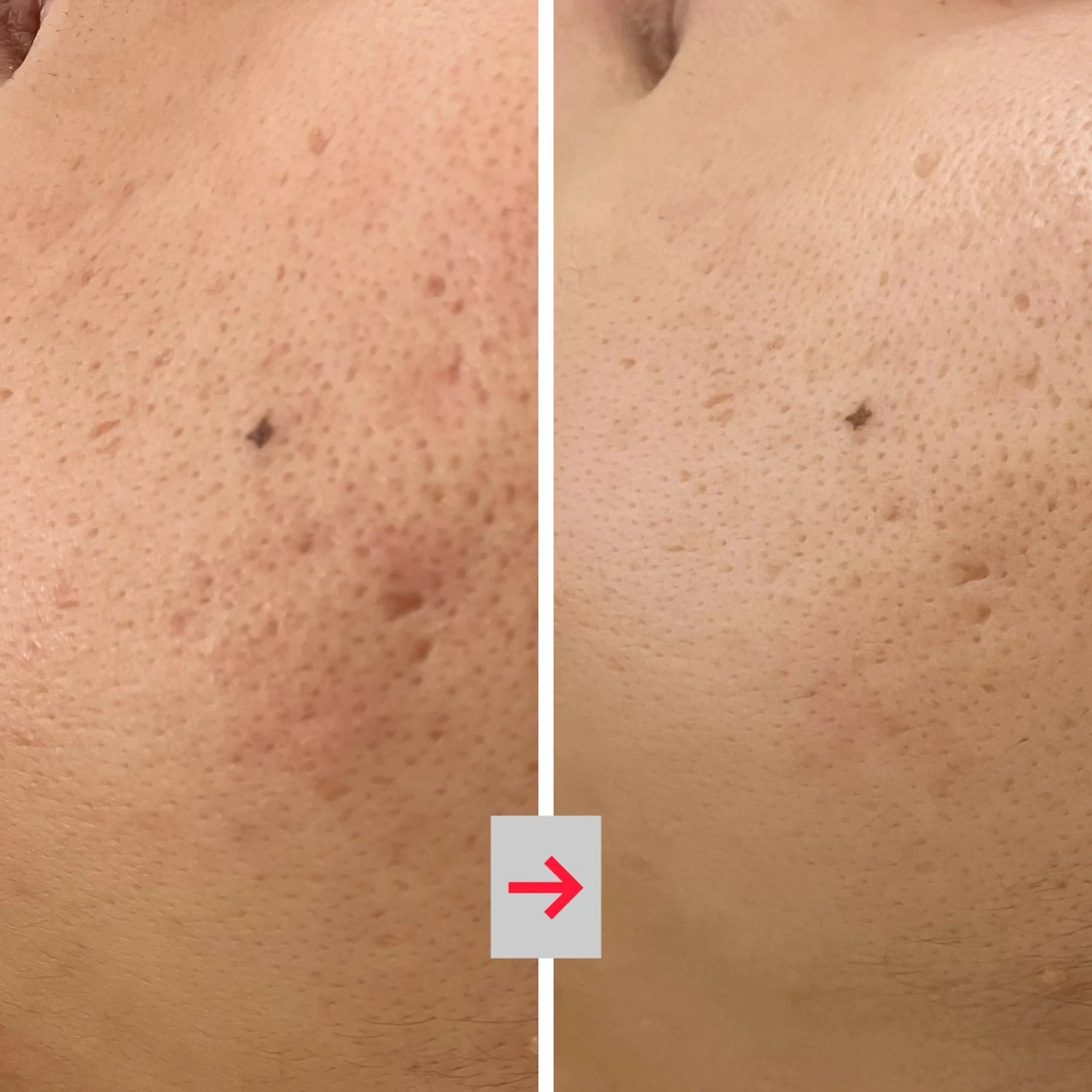 その他 たるみ改善小顔エステ 堀葉月のその他イメージ