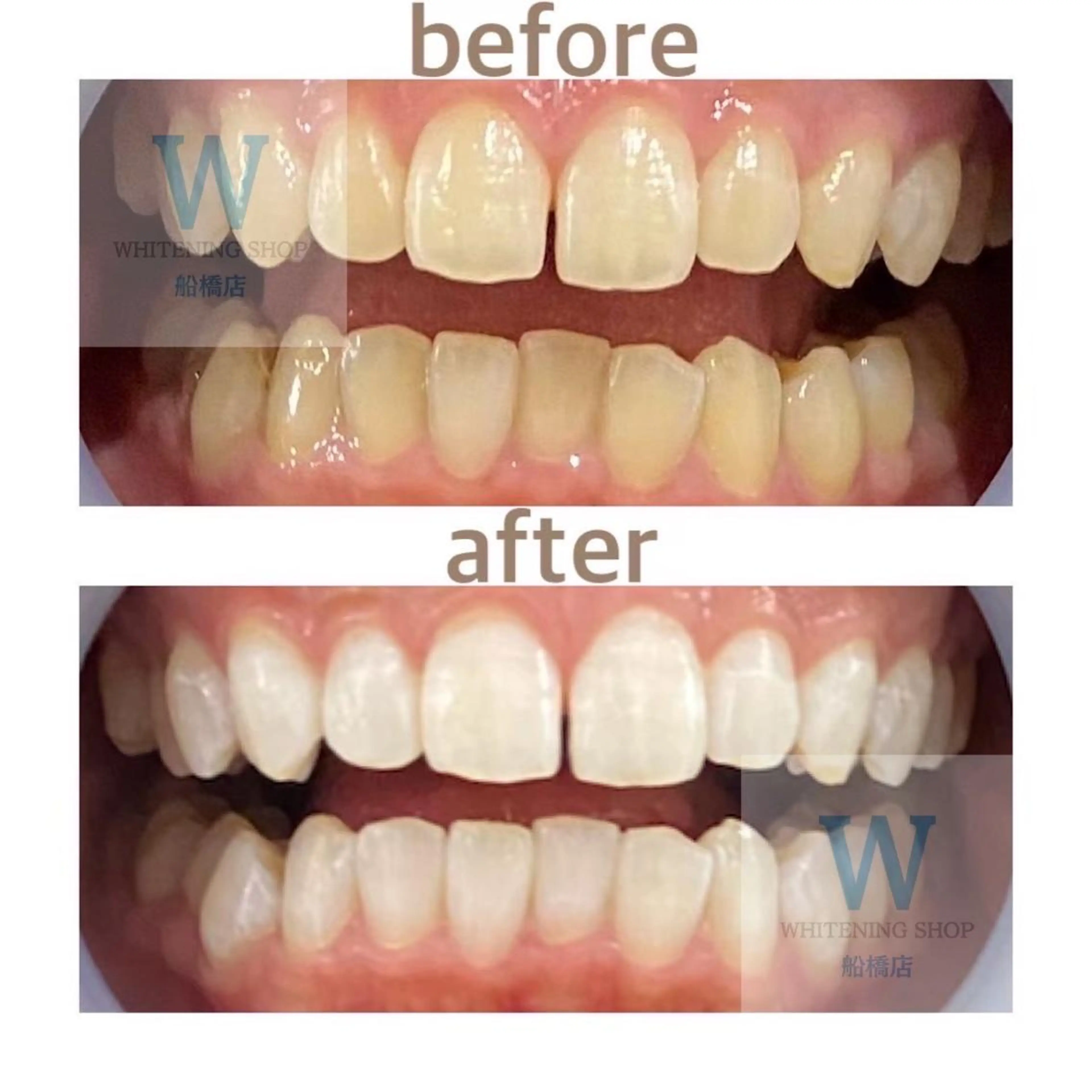 エステ リラク ホワイトニング ショップ船橋店🦷のエステ・リラクイメージ