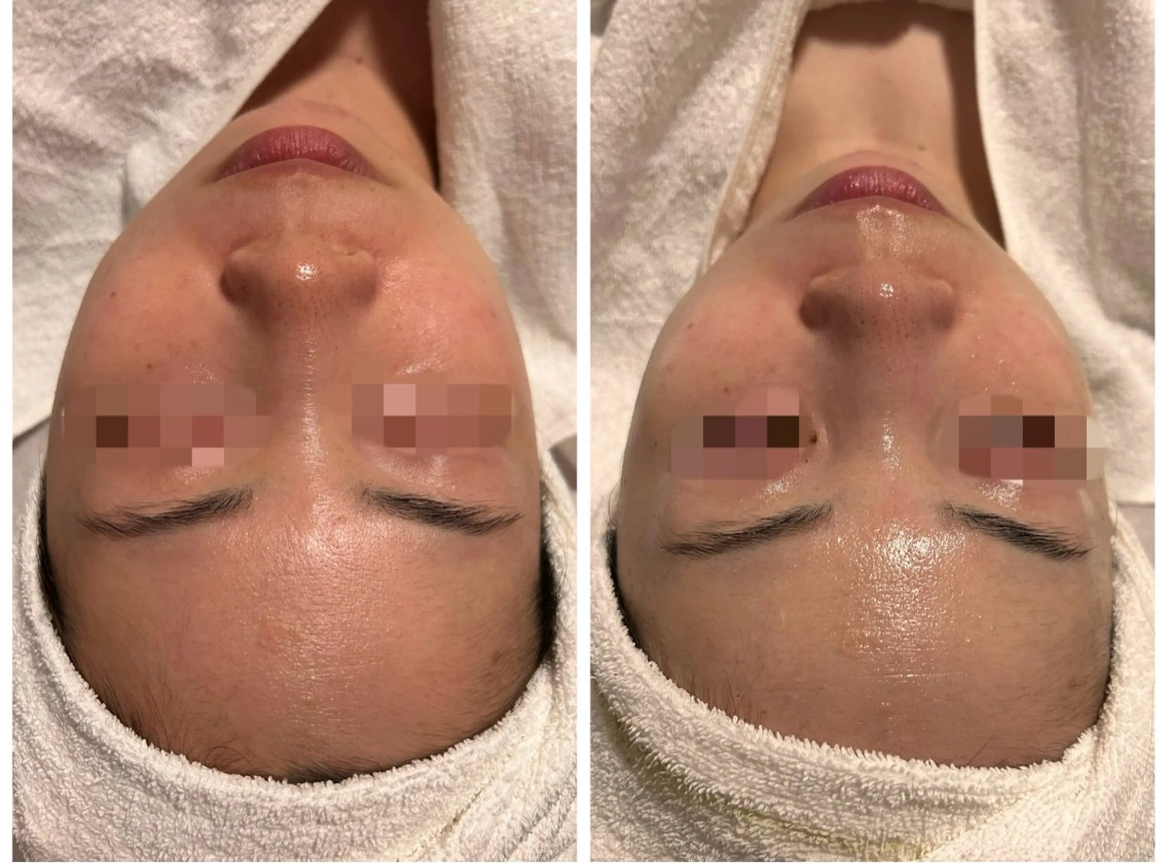 エステ リラク lumirise所属・lumi riseのエステ・リラクイメージ