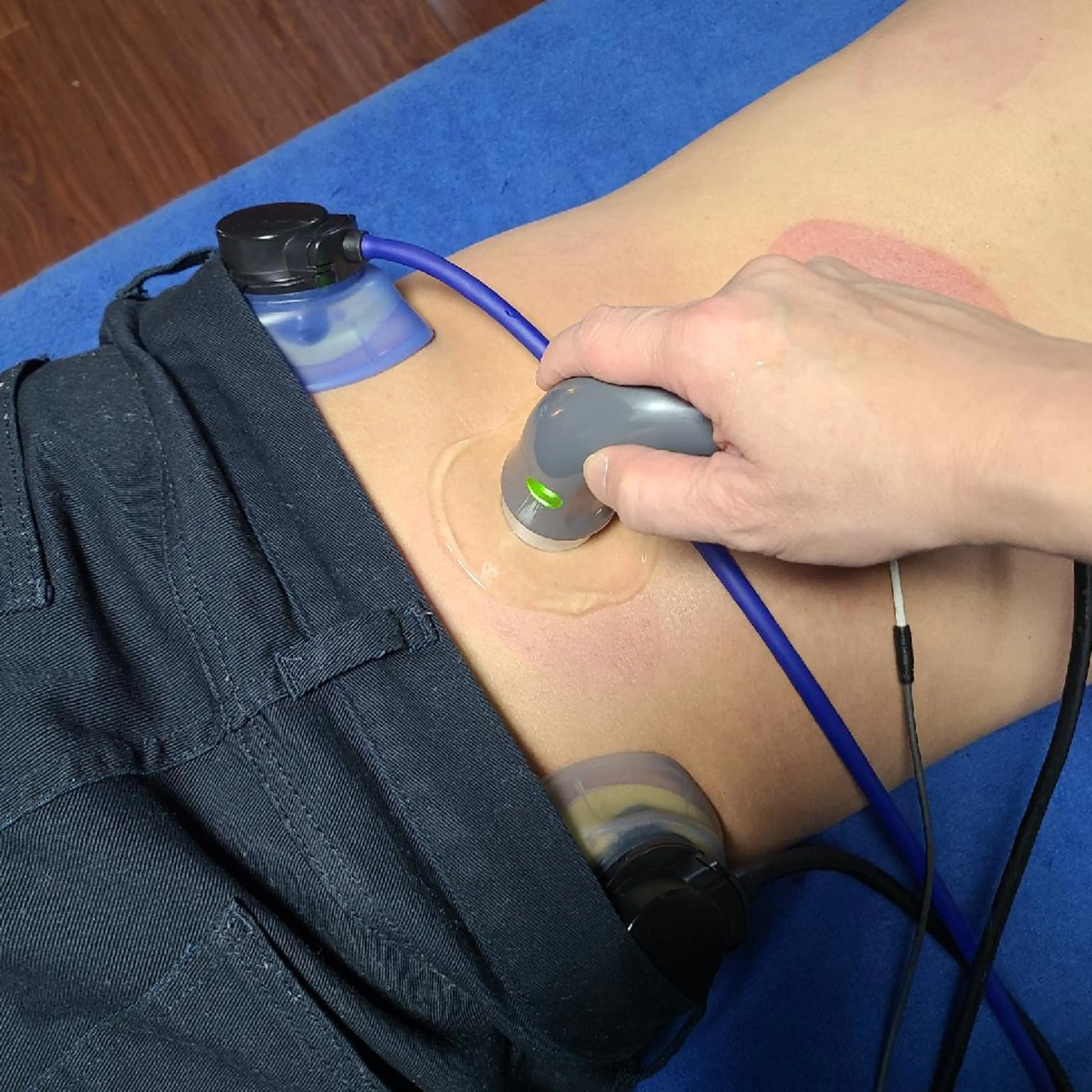 腰痛改善コース　初回6600円の写真