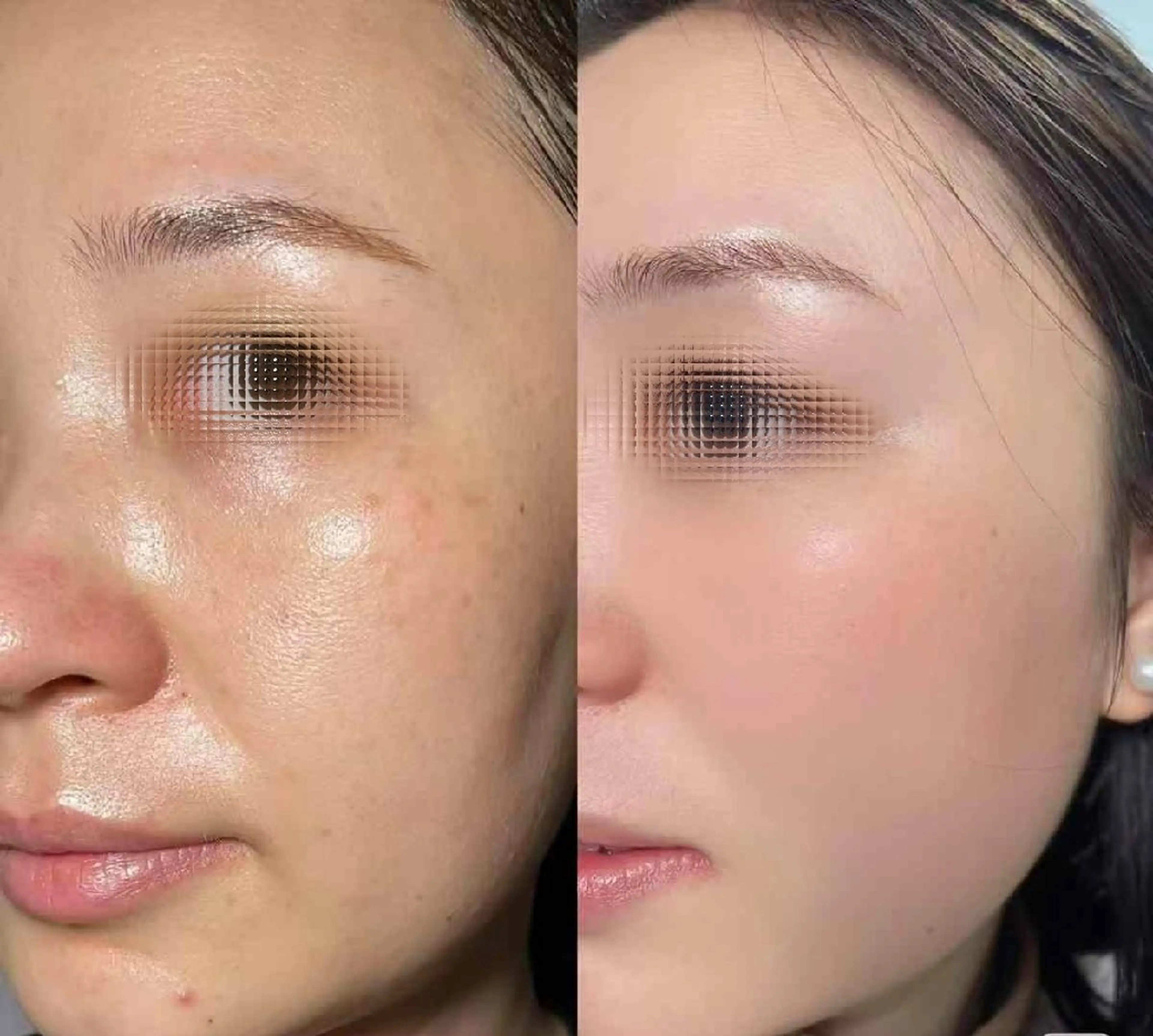 マツエク・マツパ 結婚式・ブライダル aliaハイフ&水光ジェットサロン所属・aliaハーブ水光店 エステティシャン募集のエステ・リラクイメージ