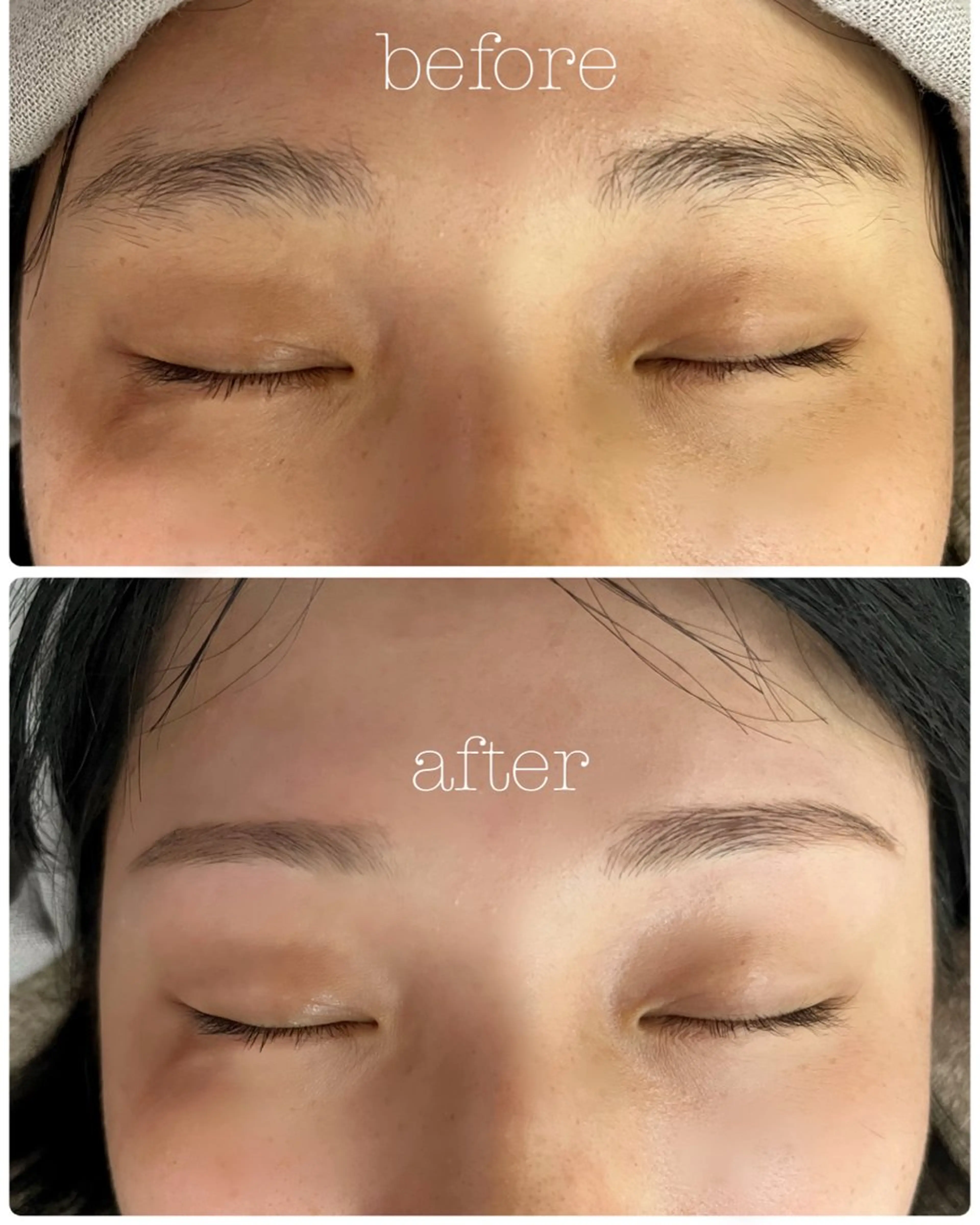 眉毛ワックス脱毛の写真