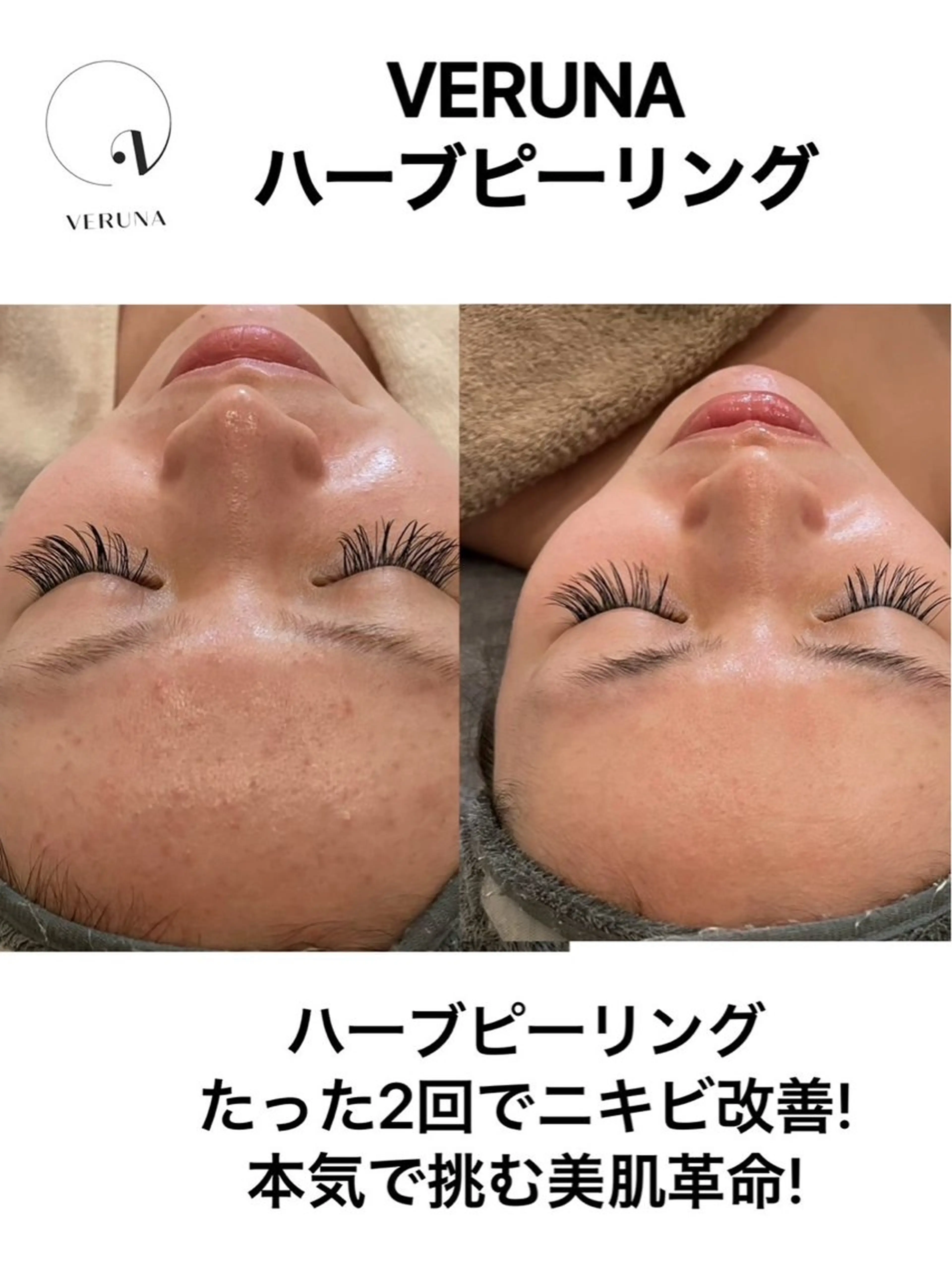 エステ ニキビ改善専門店 d'Albaのエステ・リラクイメージ