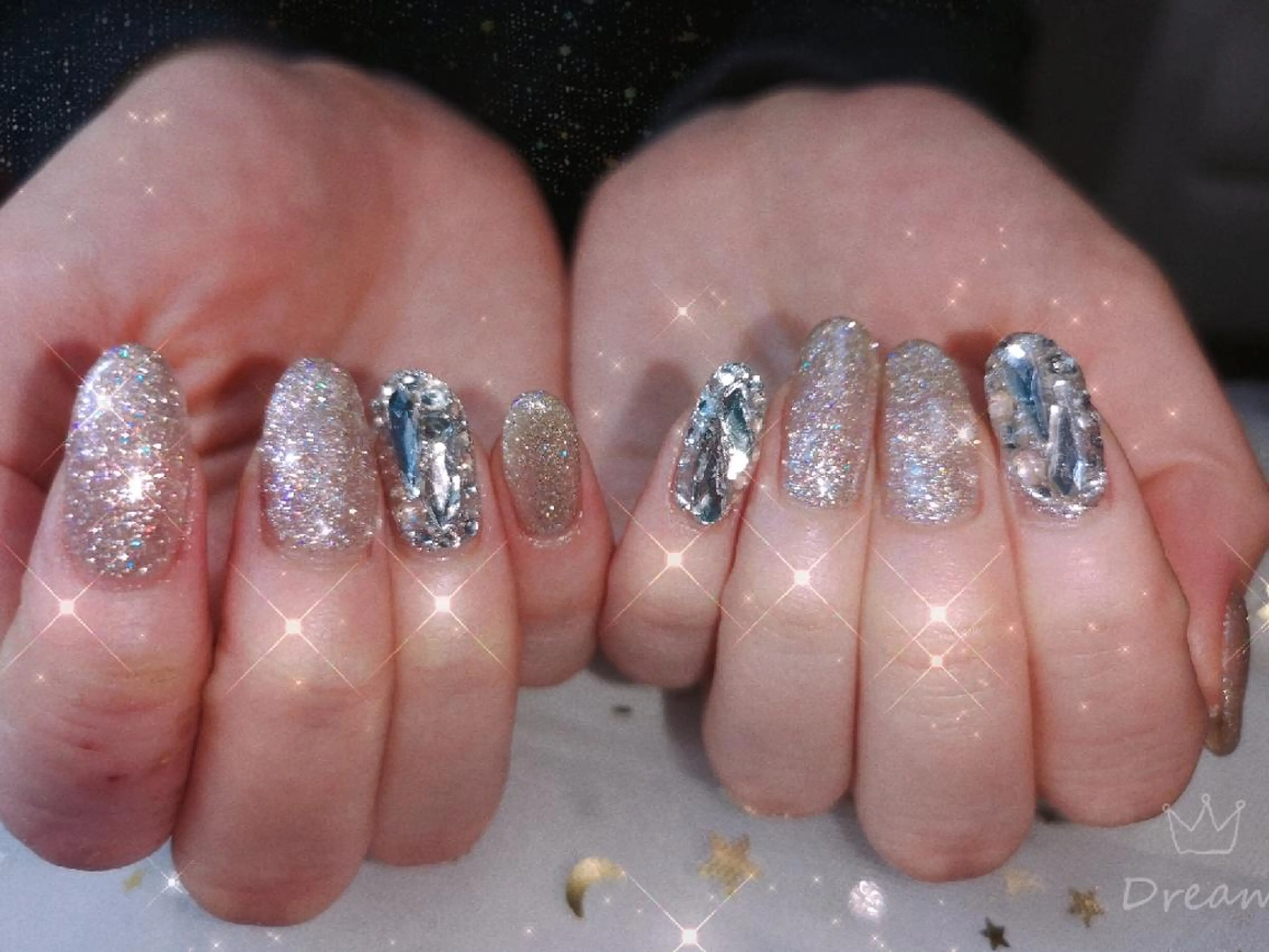 ミディアム ネイル ネイリストゆか💅 長さだし、深爪矯正のネイルデザイン