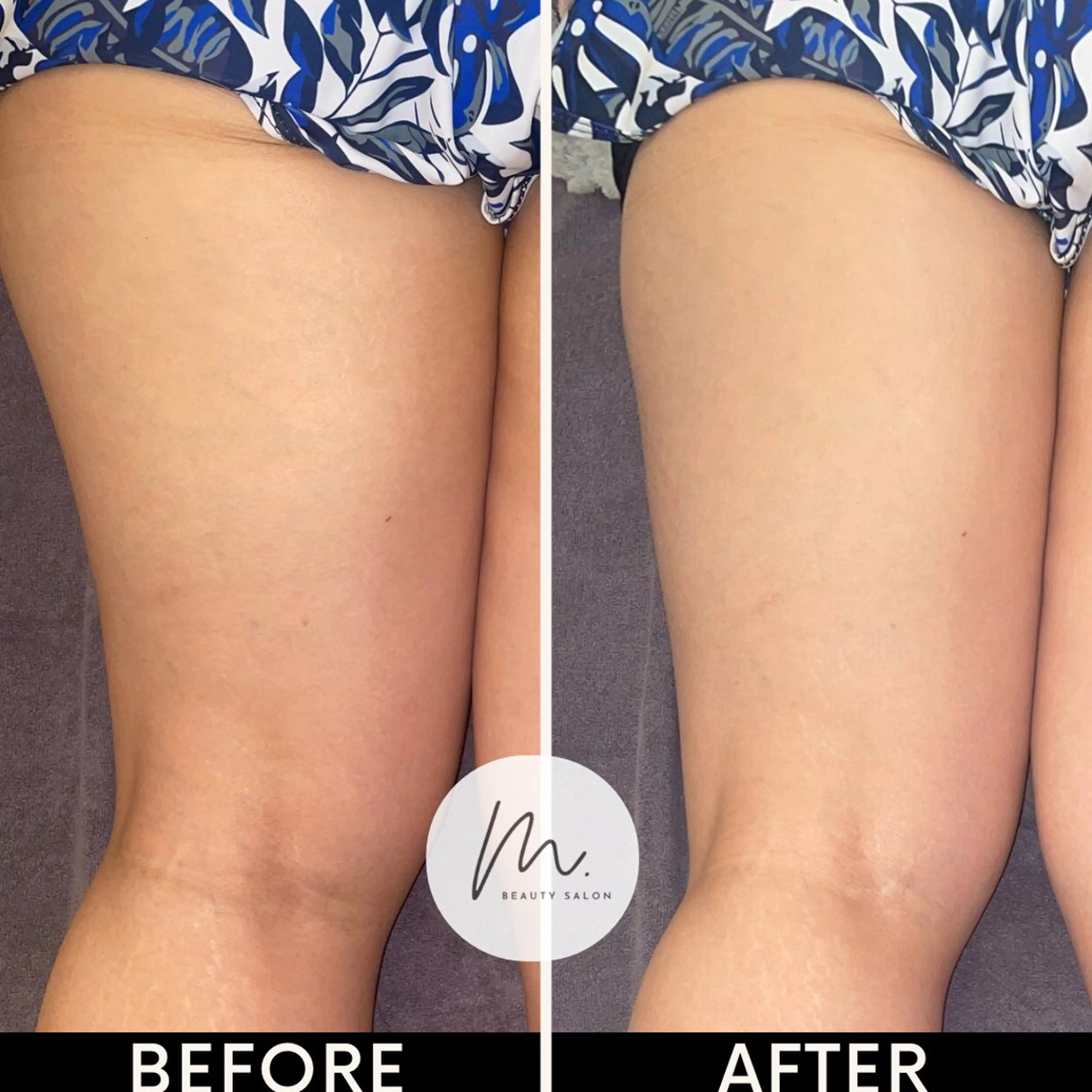 SHARES MADOKAのエステ・リラクイメージ