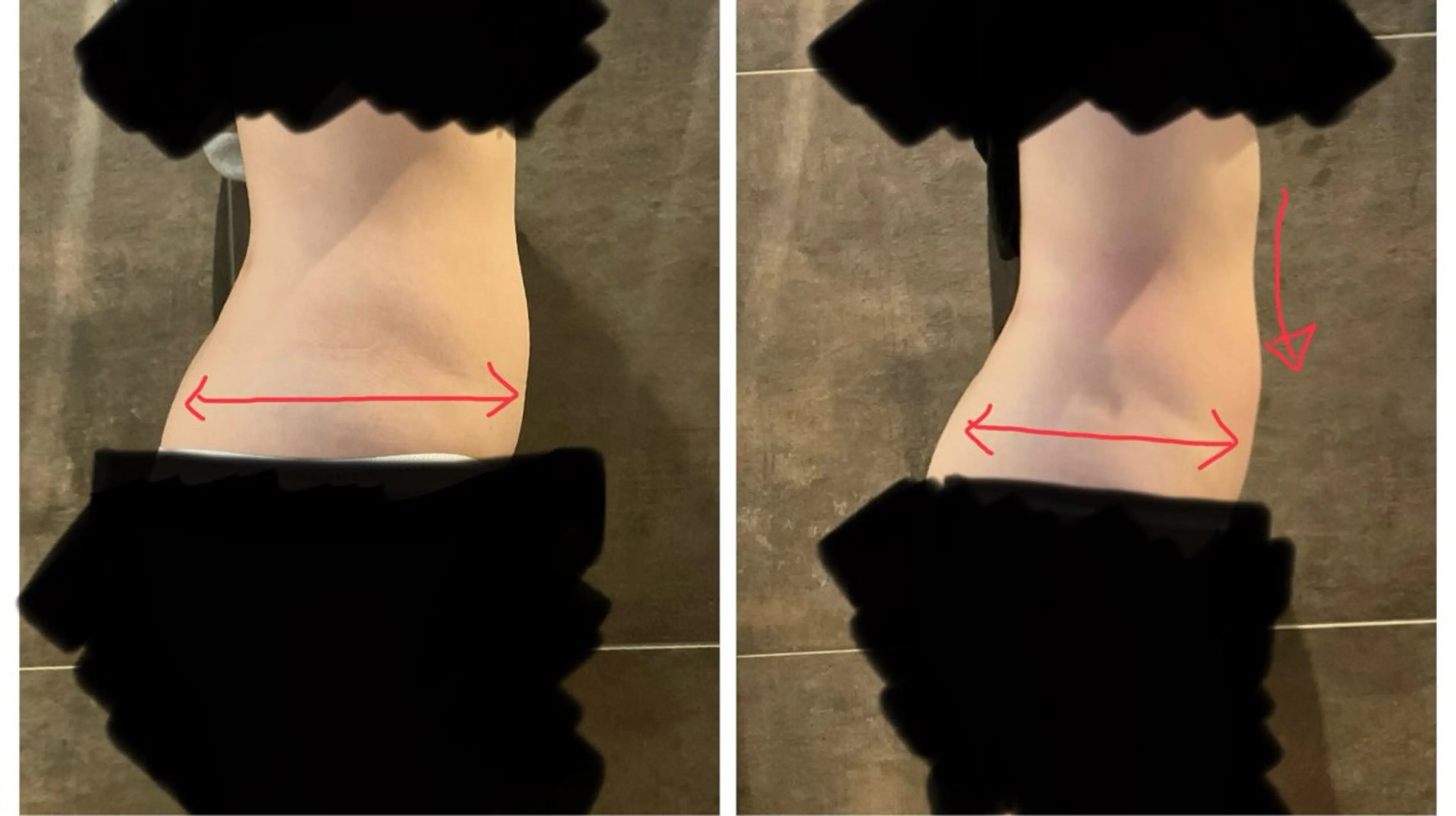 速攻!!20分で脂肪撃退!!の写真