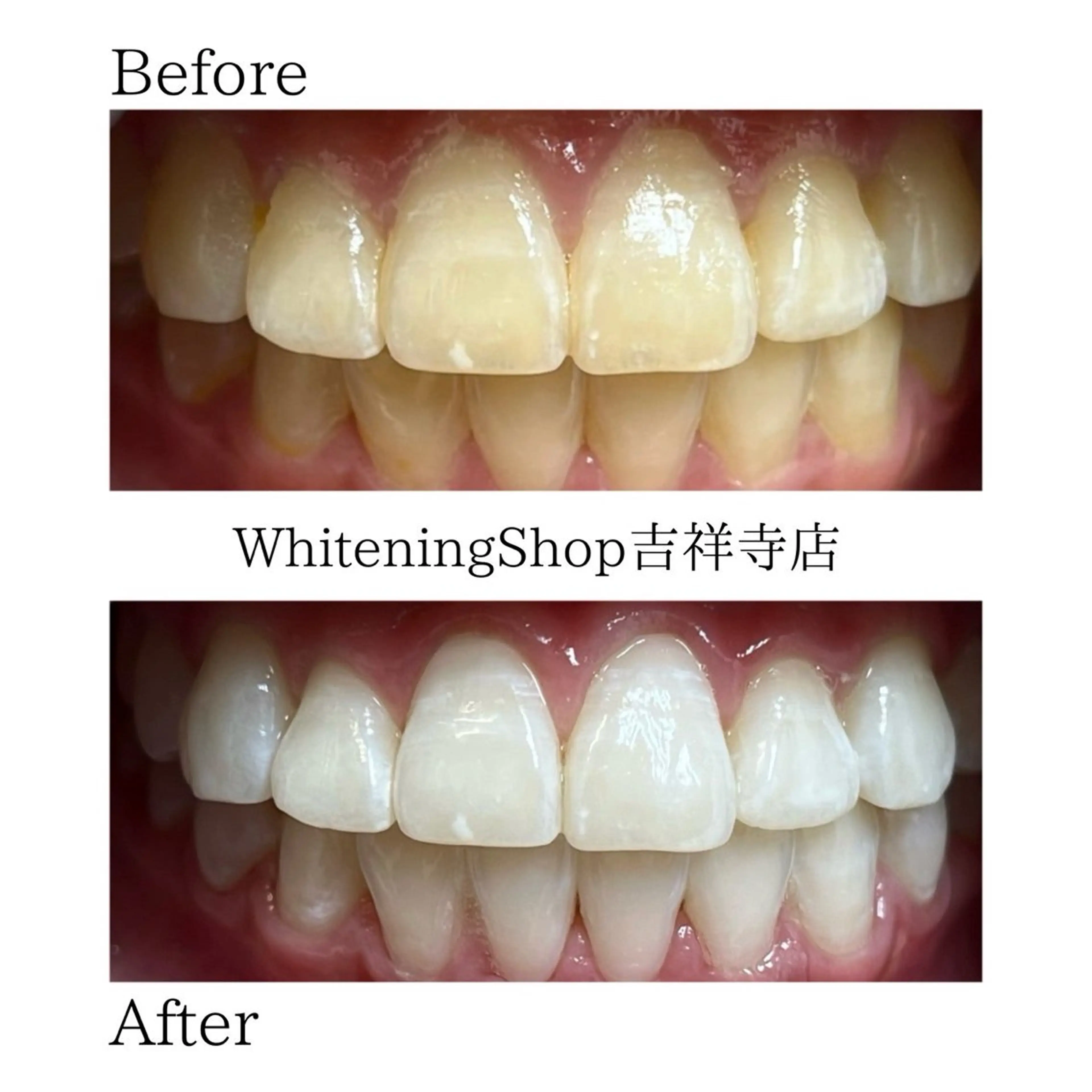 エステ リラク ホワイトニング ショップ吉祥寺店のエステ・リラクイメージ