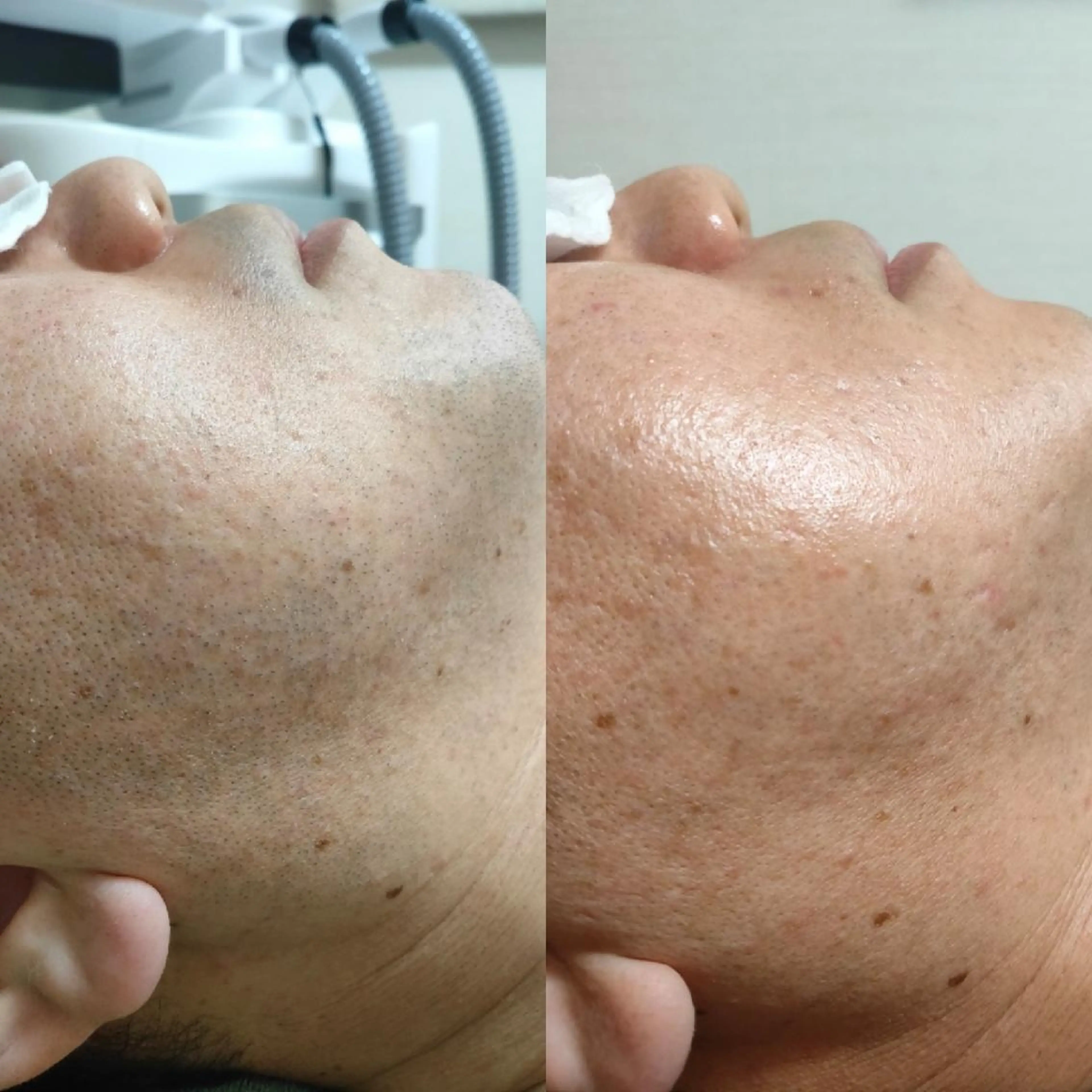 メンズ 武 藤のエステ・リラクイメージ